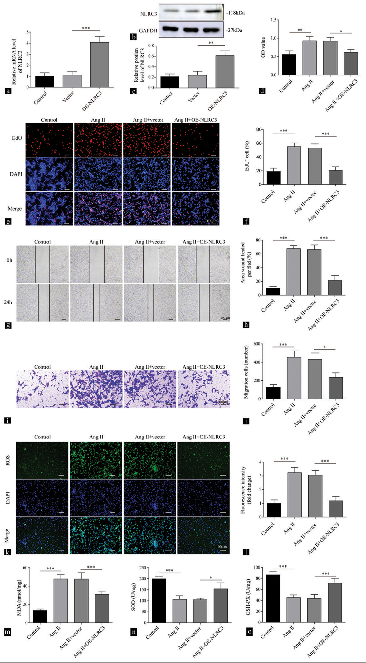 Upregulation of NLRC3 suppresses cell proliferation and oxidative stress mediated by Angiotensin II (Ang II). (a) Reverse transcription quantitative polymerase chain reaction and (b and c) Western blot analysis were conducted to detect the expression levels of NLRC3 in vascular smooth muscle cells (VSMCs) after being treated with vector or oe-NLRC3 (n = 3). (d) Cell counting kit-8 assay was used to determine cell viability of VSMCs after being treated with vehicle, Ang II (2 µM), Ang II (2 µM) + vector, and Ang II (2 µM) + oe-NLRC3. (n = 3). (e and f) EdU assay was used to assess the proliferation of VSMCs after being treated with vehicle, Ang II (2 µM), Ang II (2 µM) + vector, and Ang II (2 µM) + oe-NLRC3 (n = 3). (g and h) Wound healing assay was used to measure the migration of VSMCs treated with vehicle, Ang II (2 µM), Ang II (2 µM) + vector, and Ang II (2 µM) + oe-NLRC3 (n = 3). (i and j) Transwell assay tested cell migration capability of VSMCs treated with vehicle, Ang II (2 µM), Ang II (2 µM) + vector, and Ang II (2 µM) + oe-NLRC3 (n = 3). Crystal violet was used to stain migration cell. (k and l) Reactive oxygen species production of the VSMCs treated with vehicle, Ang II (2 µM), Ang II (2 µM) + vector, and Ang II (2 µM) + oe-NLRC3 was measured by 2’,7’-dichlorofluorescin diacetate (n = 3). (m-o) Enzyme-linked immunosorbent assay was employed to determine the levels of malondialdehyde, superoxide dismutase, and glutathione peroxidase in VSMCs treated with vehicle, Ang II (2 µM), Ang II (2 µM) + vector, and Ang II (2 µM) + oe-NLRC3 (n = 3). (* P < 0.05, ** P < 0.01, *** P < 0.001. EdU: 5-ethynyl-2’-deoxyuridine, AngII: Angiotensin II, NLRC3: Nucleotide-binding oligomerization domain-like receptor family caspase recruitment domain containing 3.)