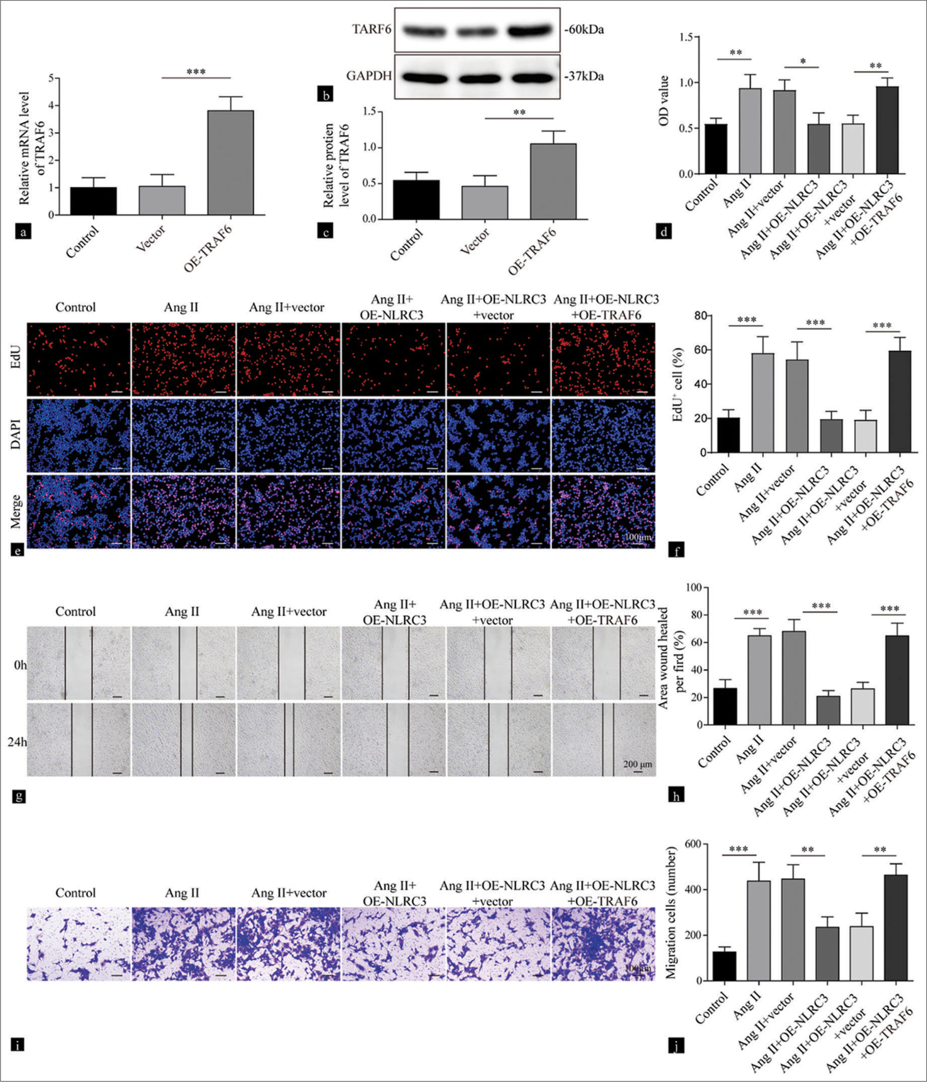 NLRC3 regulates the TRAF6/nuclear factor-kappa B axis to suppress the proliferation and migration of vascular smooth muscle cells (VSMCs) treated with Angiotensin II (Ang II). (a) Reverse transcription quantitative polymerase chain reaction and (b and c) Western blot analysis were performed to detect the expression levels of TRAF6 in VSMCs treated with vector or oe-TRAF6 (n = 3). (d) Cell viability of VSMCs treated with vehicle, Ang II (2 µM), Ang II (2 µM) + vector, Ang II (2 µM) + oe-NLRC3, Ang II (2 µM) + oe-NLRC3+ vector, and Ang II (2 µM) + oeNLRC3 + oe-TRAF6 was evaluated by Cell counting kit-8 assay (n = 3). (e and f) Proliferation of the VSMCs treated with vehicle, Ang II (2 µM), Ang II (2 µM) + vector, Ang II (2 µM) + oe-NLRC3, Ang II (2 µM) + oe-NLRC3+vector, and Ang II (2 µM) + oe-NLRC3+ oe-TRAF6 was assessed by EdU assay (n = 3). (g and h) Migration of the VSMCs treated with vehicle, Ang II (2 µM), Ang II (2 µM) + vector, Ang II (2 µM) + oe-NLRC3, Ang II (2 µM) + oe-NLRC3 + vector, and Ang II (2 µM) + oe-NLRC3+oe-TRAF6 at 0 and 24 h was evaluated by wound-healing assay (n = 3). (i and j) Transwell assay was performed to measure the migration capacity of the VSMCs treated with vehicle, Ang II (2 µM), Ang II (2 µM) + vector, Ang II (2 µM) + oe-NLRC3, Ang II (2 µM) + oe-NLRC3 + vector, and Ang II (2 µM) +oe-NLRC3 + oe-TRAF6 (n = 3) Crystal violet was used to stain migration cell. (* P < 0.05, ** P < 0.01, *** P < 0.001. EdU: 5-ethynyl-2’-deoxyuridine, AngII: Angiotensin II, NLRC3: Nucleotide-binding oligomerization domain-like receptor family caspase recruitment domain containing 3, TRAF6: tumor necrosis factor receptor-associated factor 6.)