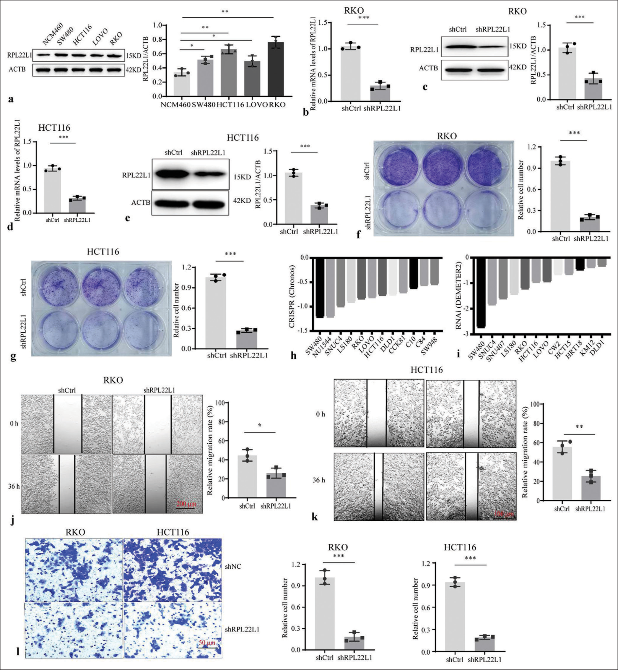 Knockdown of RPL22L1 and detection of its biological function. (a) Protein level of RPL22L1 in CRC cell lines and colonic epithelial cell line NCM460. (b-e) Western blot and qRT-PCR were conducted to identify the RPL22L1 expression downregulation in CRC cells. (f and g) Knockdown of RPL22L1 inhibited the proliferation of RKO and HCT116 cells. (h and i) Effect of RPL22L1 knockout and/or knockdown on the growth of CRC cells based on the DepMap portal. (j–k) Using wound healing experiments and (l) Transwell assays, the effect of RPL22L1 on RKO and HCT116 cell migration was identified. (n = 3; *P < 0.05, **P < 0.01, ***P < 0.001. CRC: Colorectal cancer, RPL22L1: Ribosomal Protein L22-Like 1, shCtrl: Control short hairpin RNA; siRPL22L1: RPL22L1-specific short hairpin RNA, qRTPCR: Quantitative real-time polymerase chain reaction.)