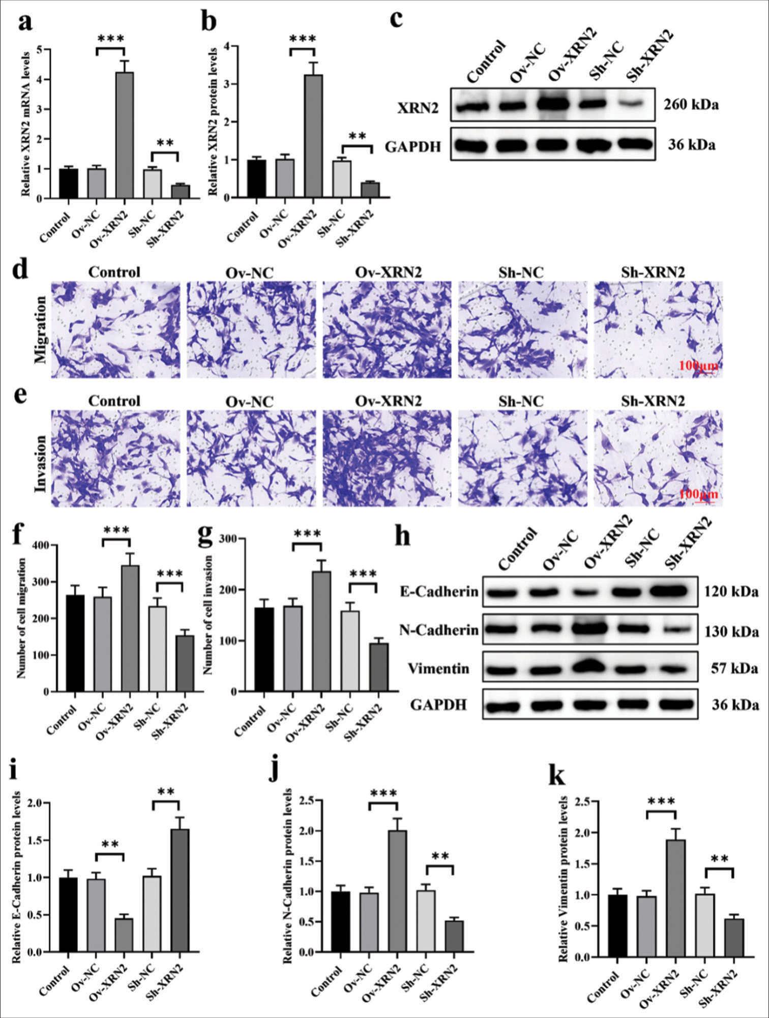 XRN2 promoted migration and EMT progression in NSCLC cells. (a-c) Validation of XRN2 overexpression and knockdown efficiency in H460 cells. (d-g) Migration and invasion assay of H460 cells after XRN2 overexpression and knockdown. (h-k) Protein levels of E-cadherin, N-cadherin, and vimentin in H460 cells after XRN2 overexpression and knockdown. n = 6. (**P < 0.01 and ***P < 0.001). (Ov-NC: Overexpress negative control, XRN2: 5’-3’ exoribonuclease 2, Sh-NC: ShRNA negative control, GAPDH: Glyceraldehyde-3-phosphate dehydrogenase, H460 cells: NSCLC cell line, BEAS-2B: Human bronchial epithelial cells, NSCLC: Non-small-cell lung cancer.)