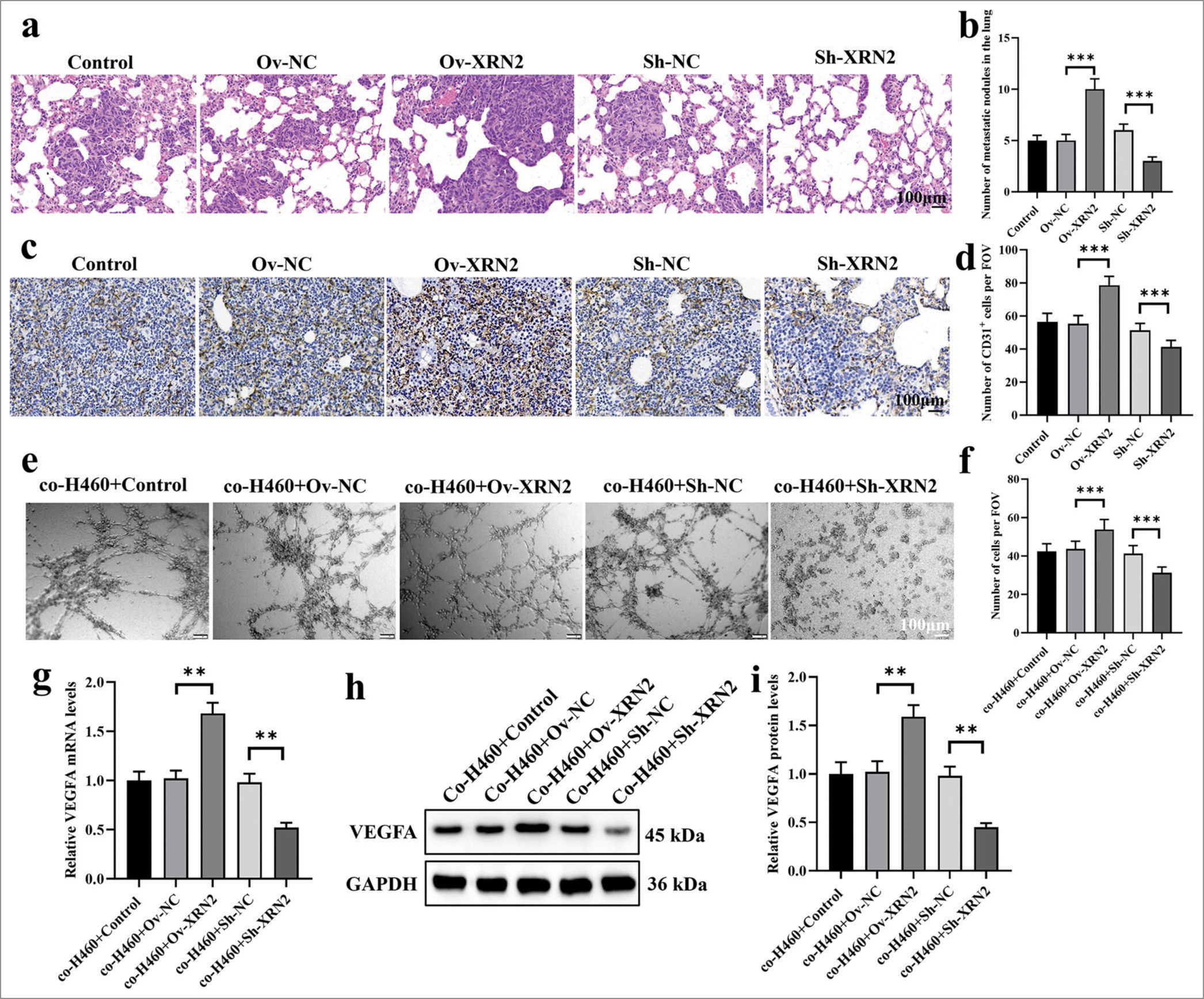 XRN2 promoted angiogenesis in NSCLC lung metastasis. (a and b) HE stained images of lung metastases. (c and d) IHC analysis of CD31 + cells in lung metastatic lesions. (e and f) Images of tube formation by HUVECs co-cultured with H460-Ov-XRN2 or H460-Sh-XRN2 cells. (g-i) mRNA and protein expression levels of VEGFA in HUVECs under co-culture conditions. n = 6. (**P < 0.01; ***P < 0.001). (Ov-NC: Overexpress negative control, XRN2: 5’-3’ exoribonuclease 2, Sh-NC: ShRNA negative control, CD31: Cluster of differentiation 31, FOV: Field of view, VEGFA: Vascular endothelial growth factor A, GAPDH: Glyceraldehyde-3-phosphate dehydrogenase, H460 cells: NSCLC cell line, BEAS-2B: Human bronchial epithelial cells, NSCLC: Non-small-cell lung cancer, Ov-XRN2: XRN2 overexpression, HUVECs: Human umbilical vein endothelial cells .)