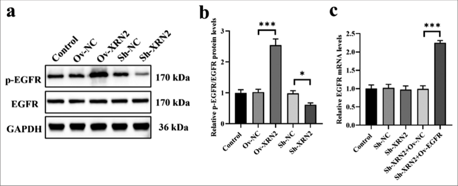 XRN2 overexpression promoted the phosphorylation of EGFR in NSCLC cells. (a) The protein bands of p-EGFR and EGFR. (b) Relative expression levels of the p-EGFR/EGFR protein ratio. (c) The EGFR mRNA levels in H460 cells. n = 6. (***P < 0.001). (Ov-NC: Overexpress negative control, XRN2: 5’-3’ exoribonuclease 2, Sh-NC: ShRNA negative control, EGFR: Epidermal growth factor receptor, p-EGFR: Phosphorylation epidermal growth factor receptor, GAPDH: Glyceraldehyde-3-phosphate dehydrogenase, NSCLC: Non-small-cell lung cancer.)