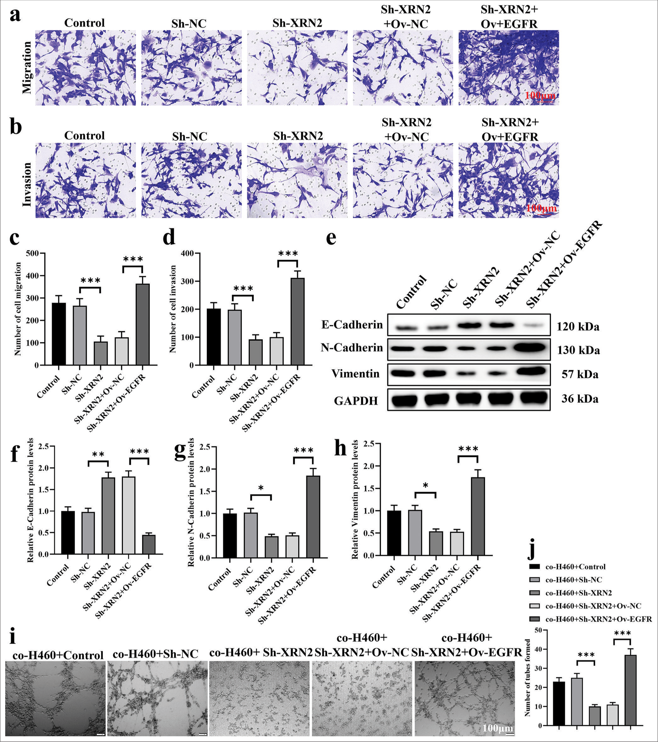 EGFR mediated the biological functions of XRN2 in NSCLC metastasis. (a-d) Transwell assays of H460 cells after transfection with Sh-XRN2 and Ov-EGFR. (e-h) The protein expression levels of E-cadherin, N-cadherin, and vimentin in H460 cells post-transfected with Sh-XRN2 and Ov-EGFR. (i and j) Tube formation by HUVECs co-cultured with H460-Sh-XRN2 or H460-Sh-XRN2+Ov-EGFR. n = 6. (*P < 0.05, **P < 0.01 and ***P < 0.001). (XRN2: 5’-3’ exoribonuclease 2, Sh-NC: ShRNA negative control, Ov-NC: overexpression negative control, EGFR: Epidermal growth factor receptor, GAPDH: Glyceraldehyde-3-phosphate dehydrogenase, NSCLC: Non-small cell lung cancer, Ov-EGFR: EGFR overexpression, HUVECs: Human umbilical vein endothelial cells.)