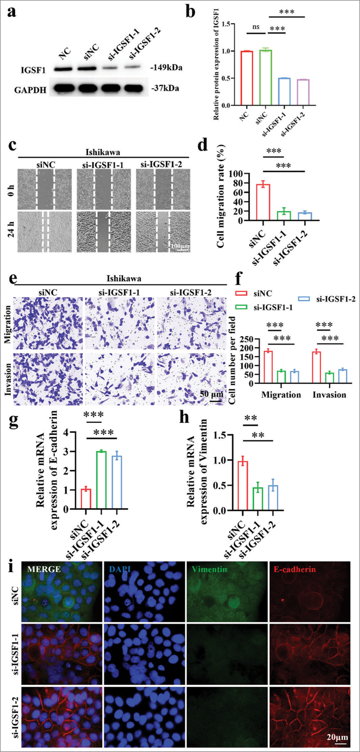 Knockdown of immunoglobulin superfamily member 1 (IGSF1) inhibited metastatic potential in Ishikawa cells. (a and b) Validation of small interfering RNA-mediated knockdown efficiency of IGSF1. (c and d) Wound healing assay demonstrating that IGSF1 knockdown suppressed the migration of Ishikawa cells. (e and f) IGSF1 knockout Ishikawa cells were analyzed through Transwell assay. (g and h) Quantitative analysis of the changes in the expressions of E-cadherin (g) and vimentin (h) following IGSF1 knockdown. (i) Immunofluorescence dual staining analysis of E-cadherin and vimentin post-IGSF1 knockdown. n = 3, ns: No statistical significance, **P < 0.01, ***P < 0.001. DAPI,4’,6-Diamidino-2’-phenylindole. NC, negative control; si-NC, negative control to IGSF1 siRNA; si-IGSF1, IGSF1 siRNA; GAPDH, glyceraldehyde-3-phosphate dehydrogenase.