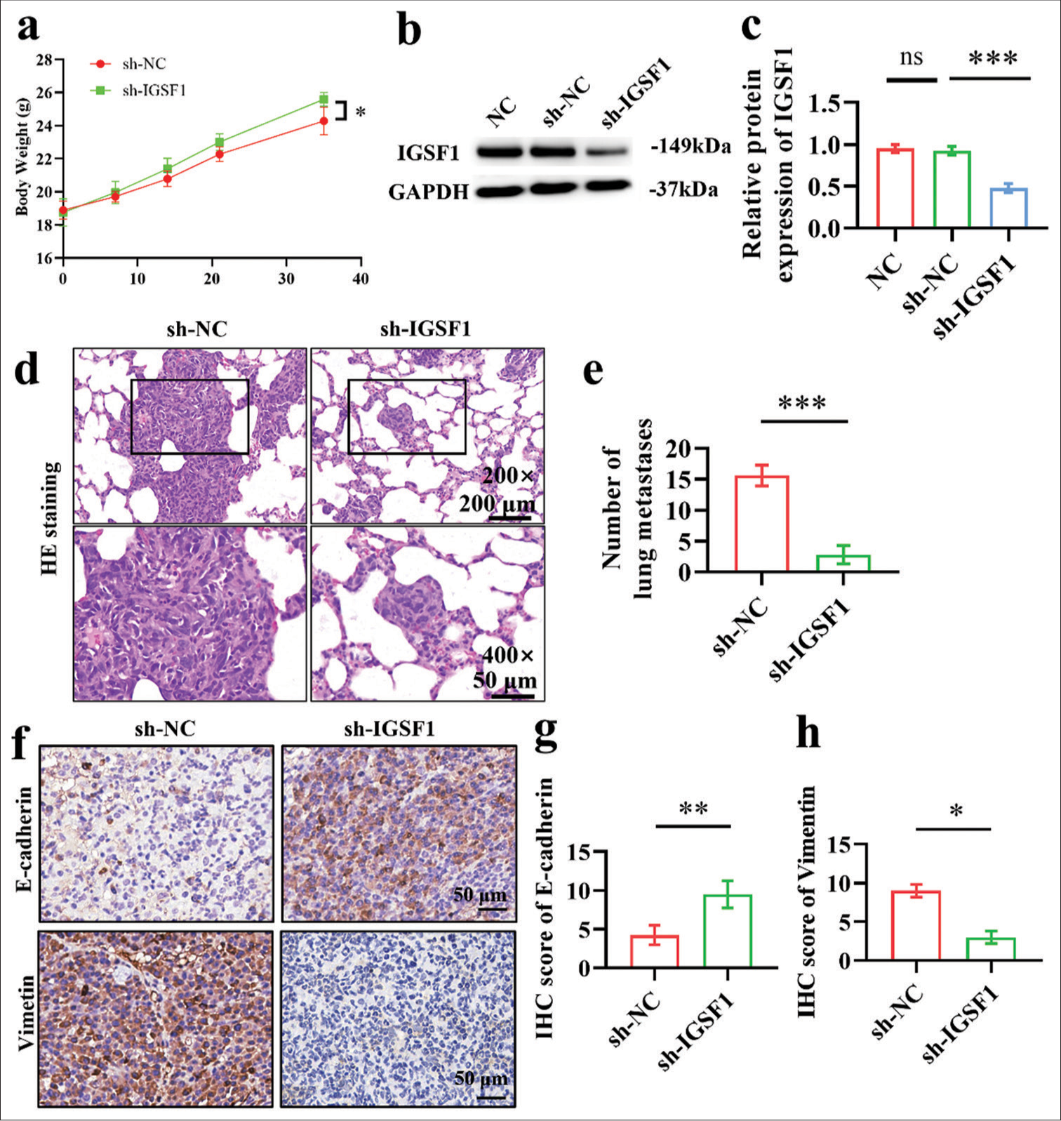 Animal model results demonstrate that immunoglobulin superfamily member 1 (IGSF1) knockdown inhibited lung metastasis of Ishikawa cells. (a) Body weight of mice with lung metastasis model. (b and c) Verification of IGSF1 knockdown effectiveness in stable Ishikawa cell lines. (d and e). Detection of lung metastases 6 weeks after tail vein injection in nude mice. (Scale: 200 mm, objective: ×200) (scale: 50 mm, objective: ×400). (f-h) Immunohistochemical staining of E-cadherin and vimentin in lung metastatic lesions. Scale bar: 50 mm. n = 6, ns: No statistical significance, *P < 0.05, **P < 0.01, ***P < 0.001. NC, negative control; sh-NC, negative control to stable IGSF1 knowown; sh-IGSF1, stable IGSF1 knowown; GAPDH, glyceraldehyde-3-phosphate dehydrogenase.