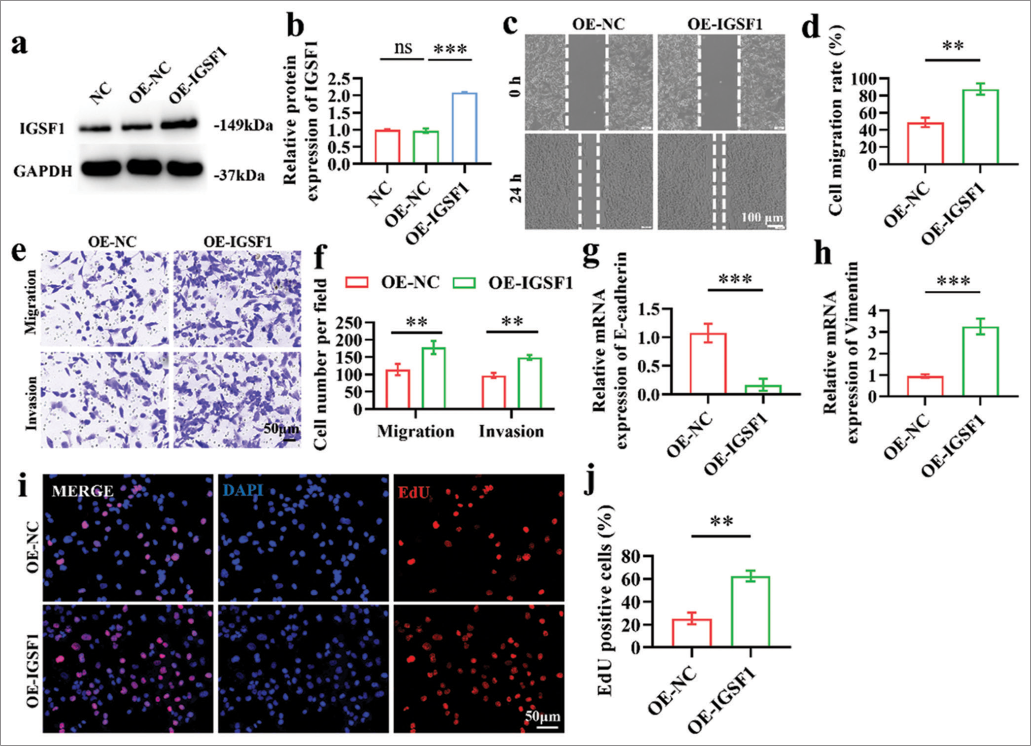 Effect of immunoglobulin superfamily member 1 (IGSF1) overexpression on Ishikawa cells. (a and b) Verification of overexpression efficiency of OE-IGSF1. (c and d) Wound healing assay indicating the enhanced migration of Ishikawa cells with IGSF1 overexpression. Scale bar: 100 mm. (e and f) Transwell assays showing increased migration and invasion capabilities. Scale bar: 50 mm. (g and h) Quantitative analysis using quantitative real-time polymerase chain reaction conducted to assess the changes in the expression of E-cadherin (g) and vimentin (h) markers following the overexpression of IGSF1. (i and j). 5-ethynyl-2’-deoxyuridine assay illustrating changes in cell the proliferation capacity after IGSF1 overexpression. Scale bar: 50 mm. n = 3, ns: No statistical significance, **P < 0.01, ***P < 0.001. NC, negative control; OE-NC, negative control to IGSF1-overexpressing lentivirus; OE-IGSF1, IGSF1-overexpressing lentivirus; GAPDH, glyceraldehyde-3-phosphate dehydrogenase .