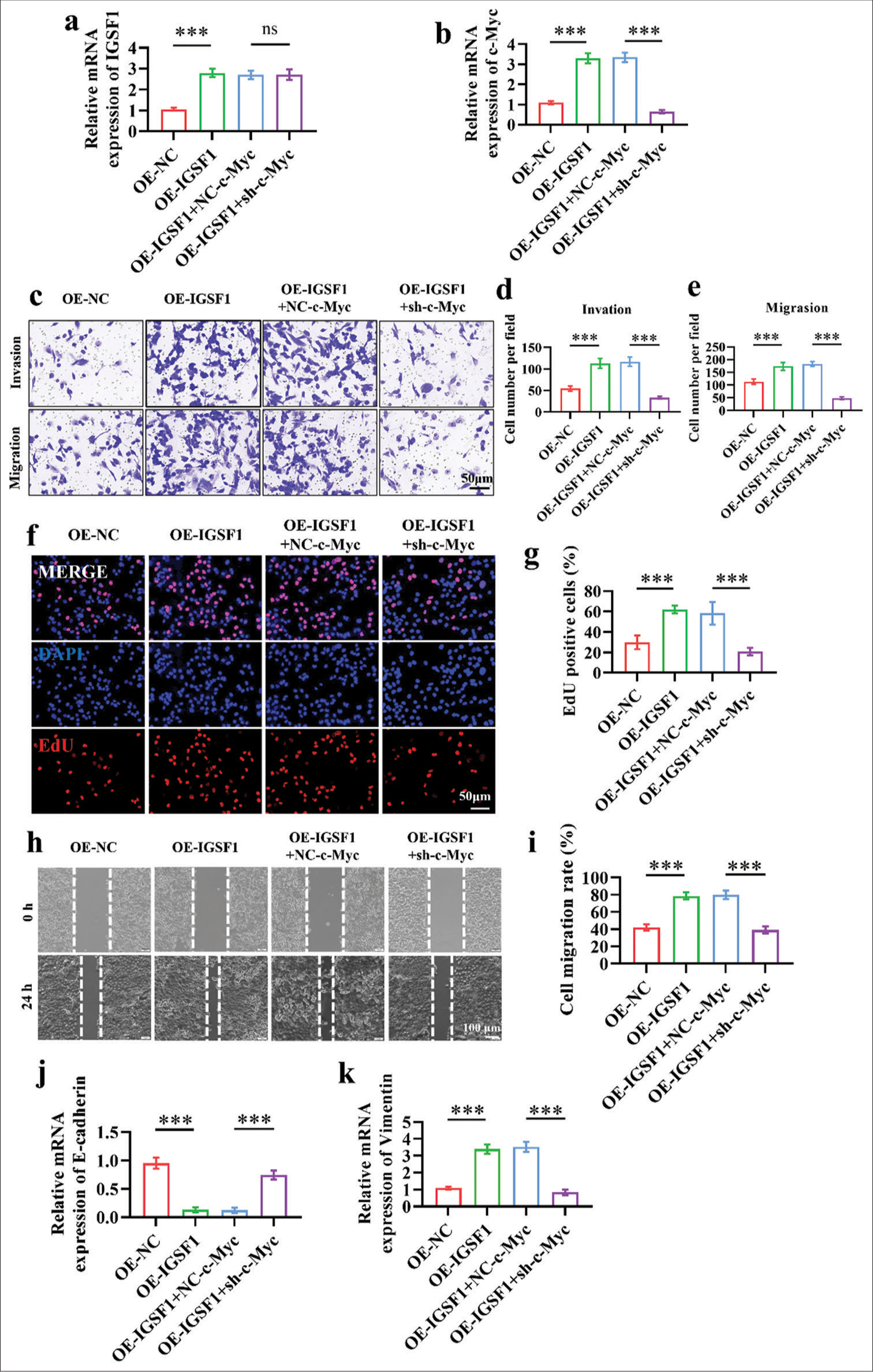 Silencing of Myc proto-oncogene (c-Myc) reversed the oncogenic effects of immunoglobulin superfamily member 1 (IGSF1). (a and b) Quantitative real-time polymerase chain reaction verification of IGSF1 expression (a) and c-Myc (b) changes in different treatment groups. (c-e) Transwell assay conducted to assess the effect of c-Myc silencing on the oncogenic effects of IGSF1. Scale bar: 50 mm. (f and g) 5-ethynyl-2’-deoxyuridine assay for the evaluation of the influence of c-Myc silencing on the oncogenic effects of IGSF1. Scale bar: 50 mm. (h and i) Wound healing assay performed to evaluate the influence of c-Myc silencing on the oncogenic effects of IGSF1. Scale bar: 100 mm. (j and k) Detection of E-cadherin (j) and vimentin (k) expression. n = 3, ns: No statistical significance, ***P < 0.001. OE-NC, negative control to IGSF1-overexpressing lentivirus; OEIGSF1, IGSF1-overexpressing lentivirus; NC-c-Myc, negative control to c-Myc interfering lentivirus; sh-Myc, c-Myc interfering lentivirus.