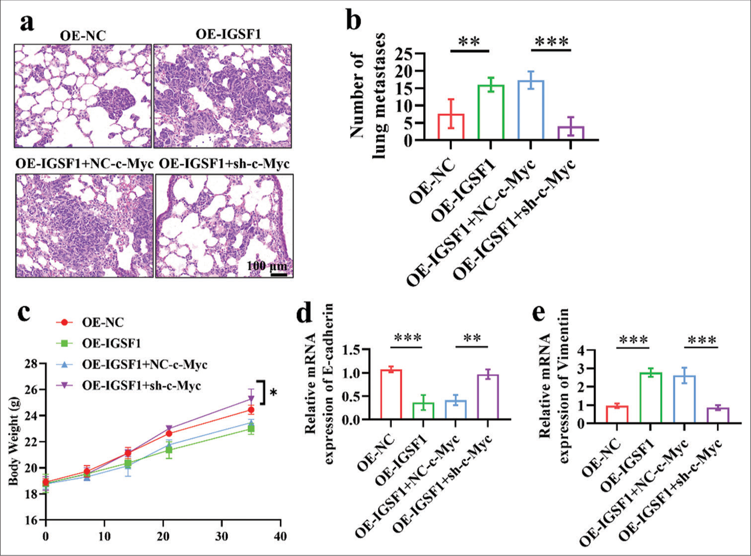 Silencing of Myc proto-oncogene reversed the prometastatic effects of immunoglobulin superfamily member 1 on lung metastasis. (a and b) Detection of lung metastases 6 weeks after tail vein injection of cells in nude mice. Scale bar: 100 mm. (c) The mice body weight. (d and e) E-cadherin (d) and vimentin (e) in lung metastatic lesions. n = 6, *P < 0.05, **P < 0.01, ***P < 0.001. OE-NC, negative control to IGSF1-overexpressing lentivirus; OE-IGSF1, IGSF1-overexpressing lentivirus; NC-c-Myc, negative control to c-Myc interfering lentivirus; sh-Myc, c-Myc interfering lentivirus.