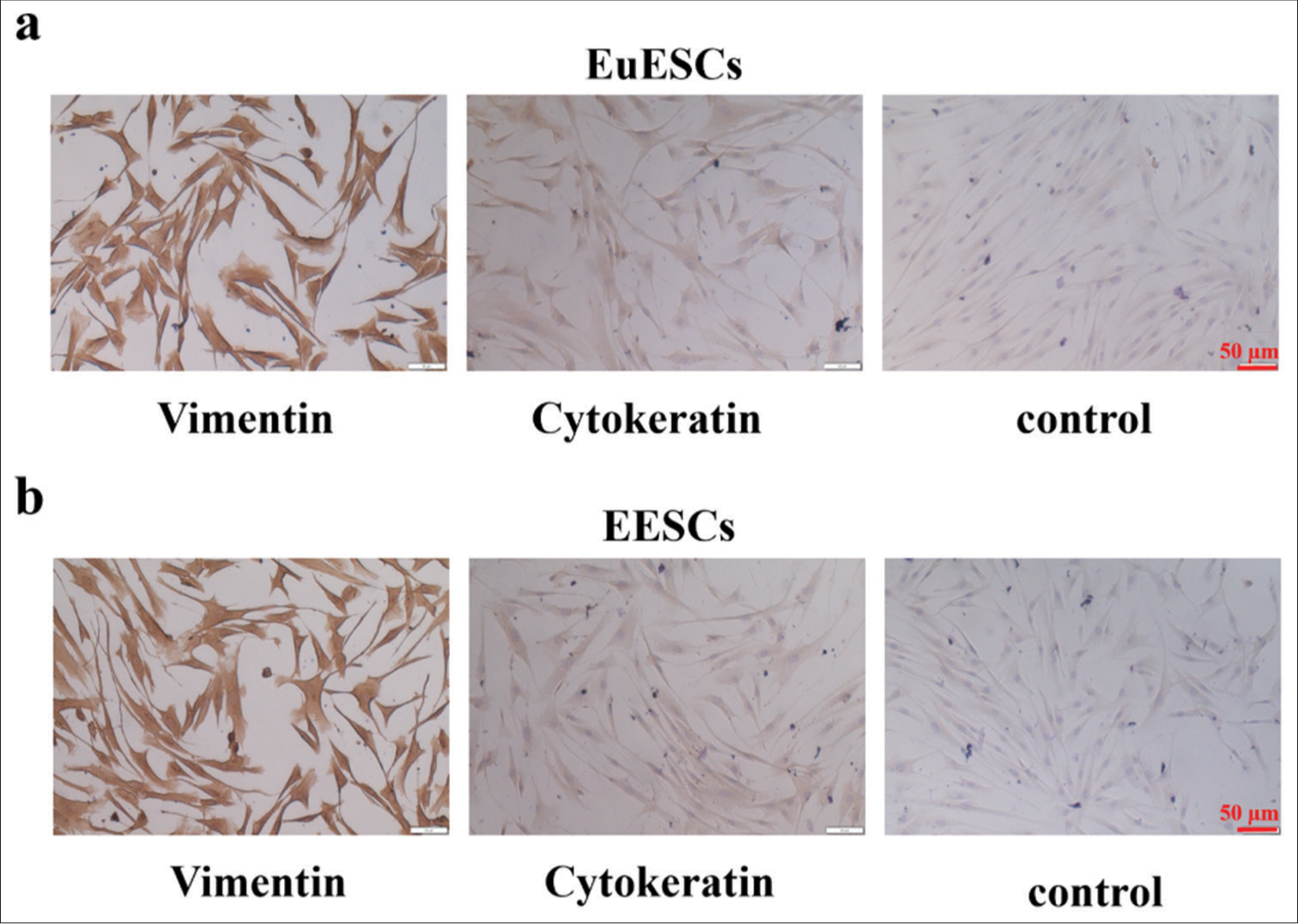 EuESCs and EESCs’ phenotypic traits were determined. (a) EuESCs’ phenotypic traits of vimentin and cytokeratin. (b). EESCs’ phenotypic traits of vimentin and cytokeratin. n = 6. (EESCs: Ectopic endometrial stromal cells, EuESCs: Eutopic endometrial stromal cells.)