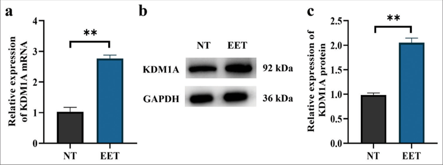 KDM1A expression was significantly increased in ectopic endometrial tissues. (a) KDM1A expression in endometrium tissues. (b and c) KDM1A protein expression tested by Western blot. n = 20. **P < 0.01. (KDM1A: Lysine-specific histone demethylase 1A, GAPDH: Glyceraldehyde-3-phosphate dehydrogenase, NT: Normal tissues, EET: Ectopic endometrial tissues)