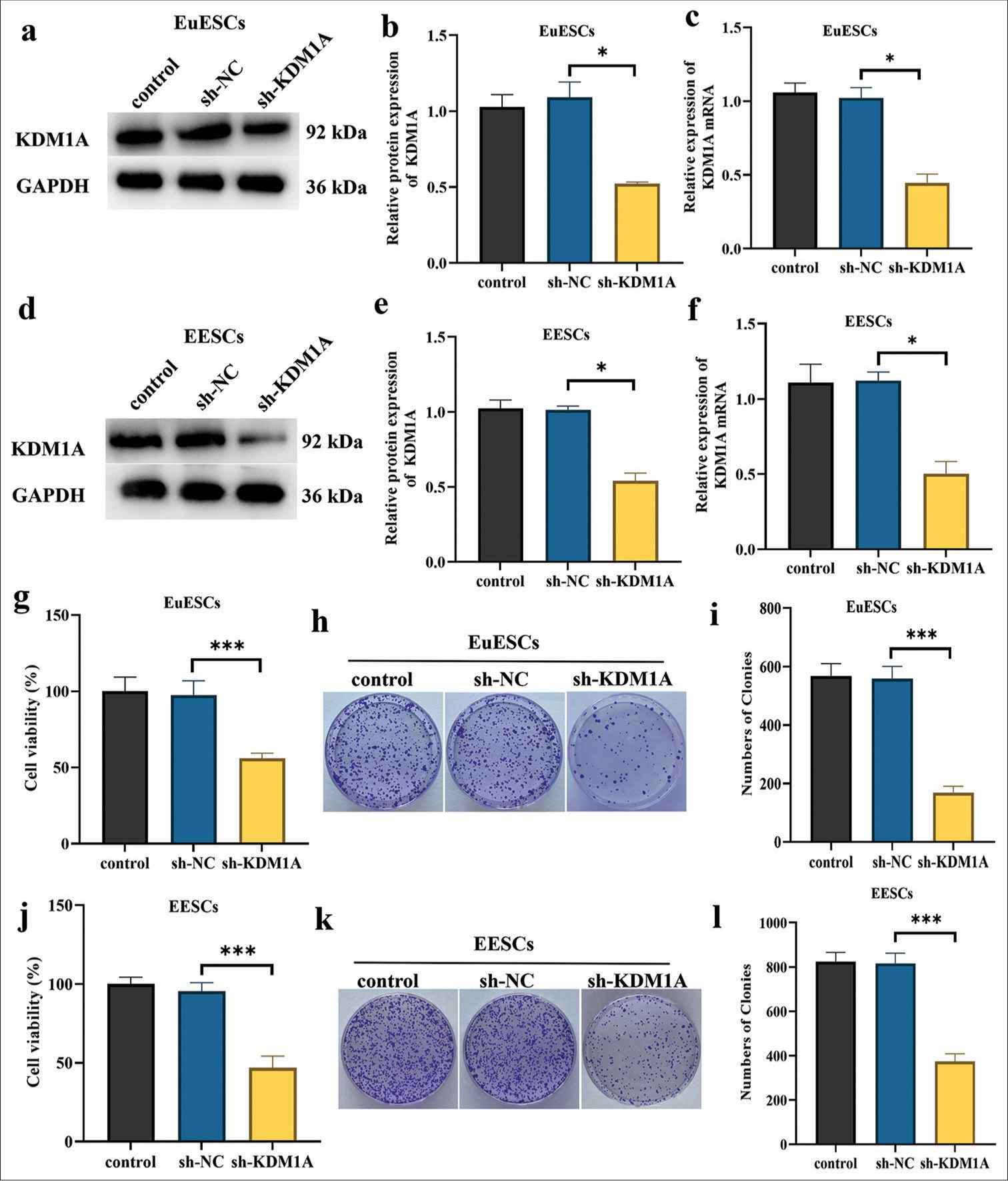 Silencing KDM1A inhibited the proliferation of EuESCs and EESCs in vitro. (a-c). Western blot and qRT-PCR determination of the mRNA and protein expression levels of KDM1A in EuESCs. (d-f). Western blot and qRT-PCR determination of the mRNA and protein expression levels of KDM1A in EESCs. (g). Cell viability of EuESCs determined by CCK-8 assay. Control group 100% cell viability as control. (h-i). Cell migration assay of EuESCs. (j). Cell viability of EuESCs determined by CCK-8 assay. Control group 100% cell viability as control. (k-l) Cell viability of EESCs determined by CCK-8 assay. n = 6. *P < 0.05, ***P < 0.001. (KDM1A: Lysine-specific histone demethylase 1A, GAPDH: Glyceraldehyde-3-phosphate dehydrogenase, EESCs: Ectopic endometrial stromal cells, EuESCs: Eutopic endometrial stromal cells, qRT-PCR: quantitative real-time polymerase chain reaction)