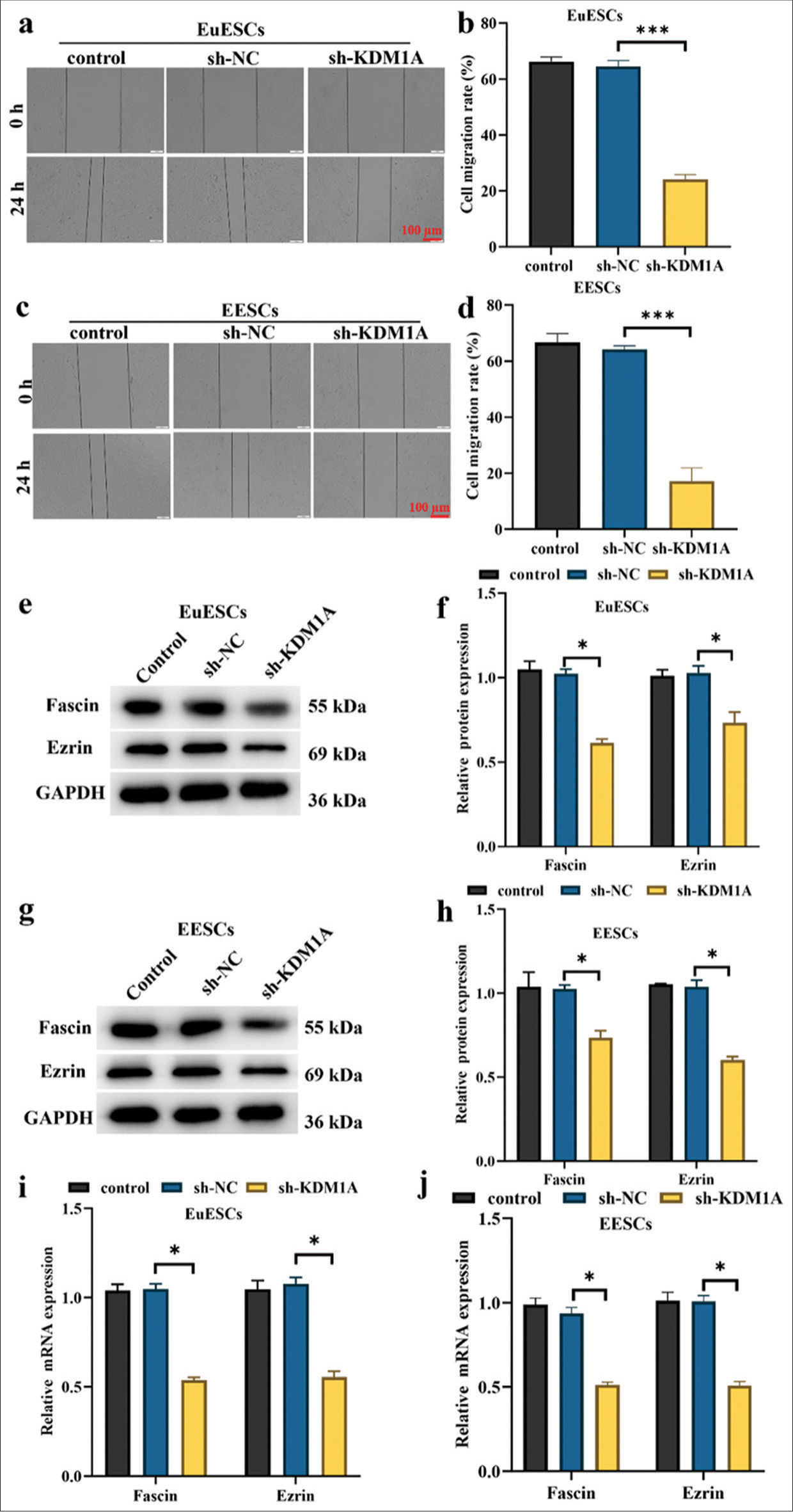 KDM1A silencing suppressed the migration of EuESCs and EESCs. (a-d) Cell migration assessed by wound healing assay. (e-h) Western blot determination of the expression levels of Fascin and Ezrin. (i and j) qRT-PCR evaluation of Fascin and Ezrin. n = 6. *P < 0.05, ***P < 0.001. (KDM1A: Lysine-specific histone demethylase 1A, GAPDH: Glyceraldehyde-3-phosphate dehydrogenase, EESCs: Ectopic endometrial stromal cells, EuESCs: Eutopic endometrial stromal cells.)