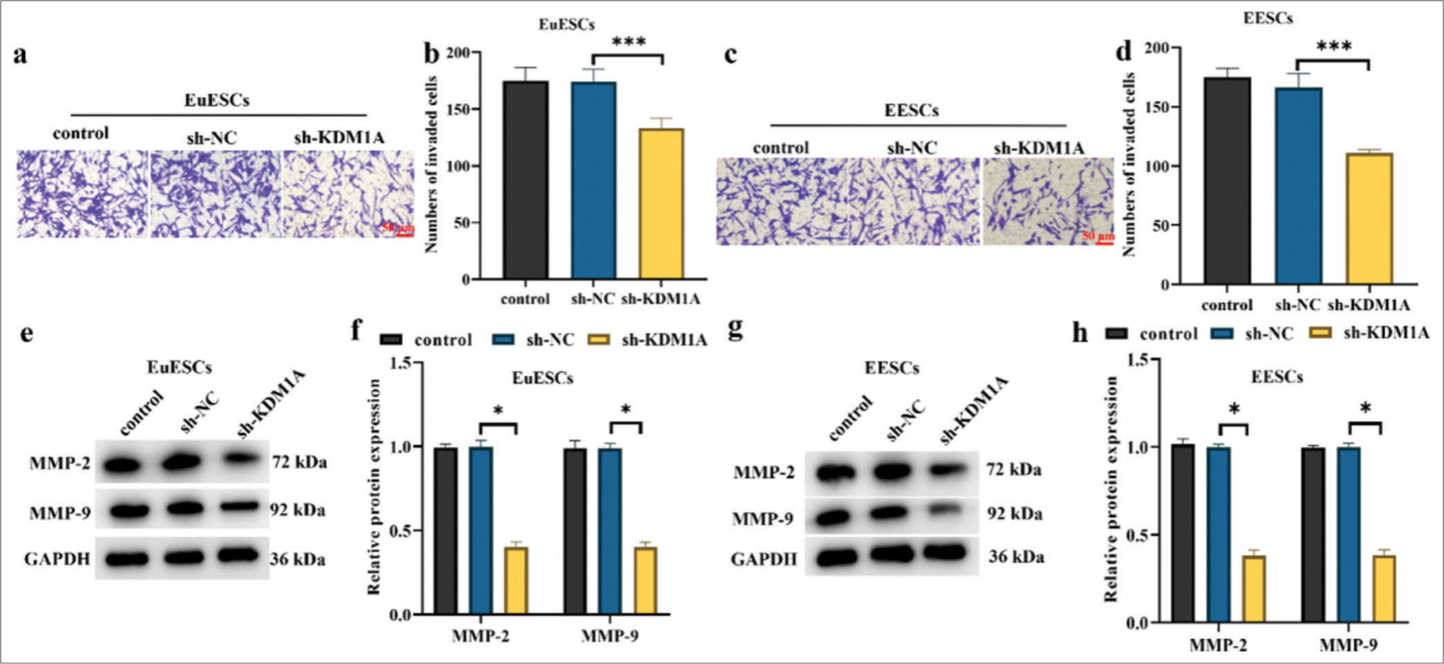 KDM1A silencing inhibited the invasion in EuESCs and EESCs. (a-d) Representative images and bar graphs for Tanswell invasion assay in EuESCs and EESCs. (e-h) Western blot detection of invasion markers in EuESCs and EESCs. n = 6. *P < 0.05, ***P < 0.001. (KDM1A: Lysine-specific histone demethylase 1A, GAPDH: Glyceraldehyde-3-phosphate dehydrogenase, EESCs: Ectopic endometrial stromal cells, EuESCs: Eutopic endometrial stromal cells.)