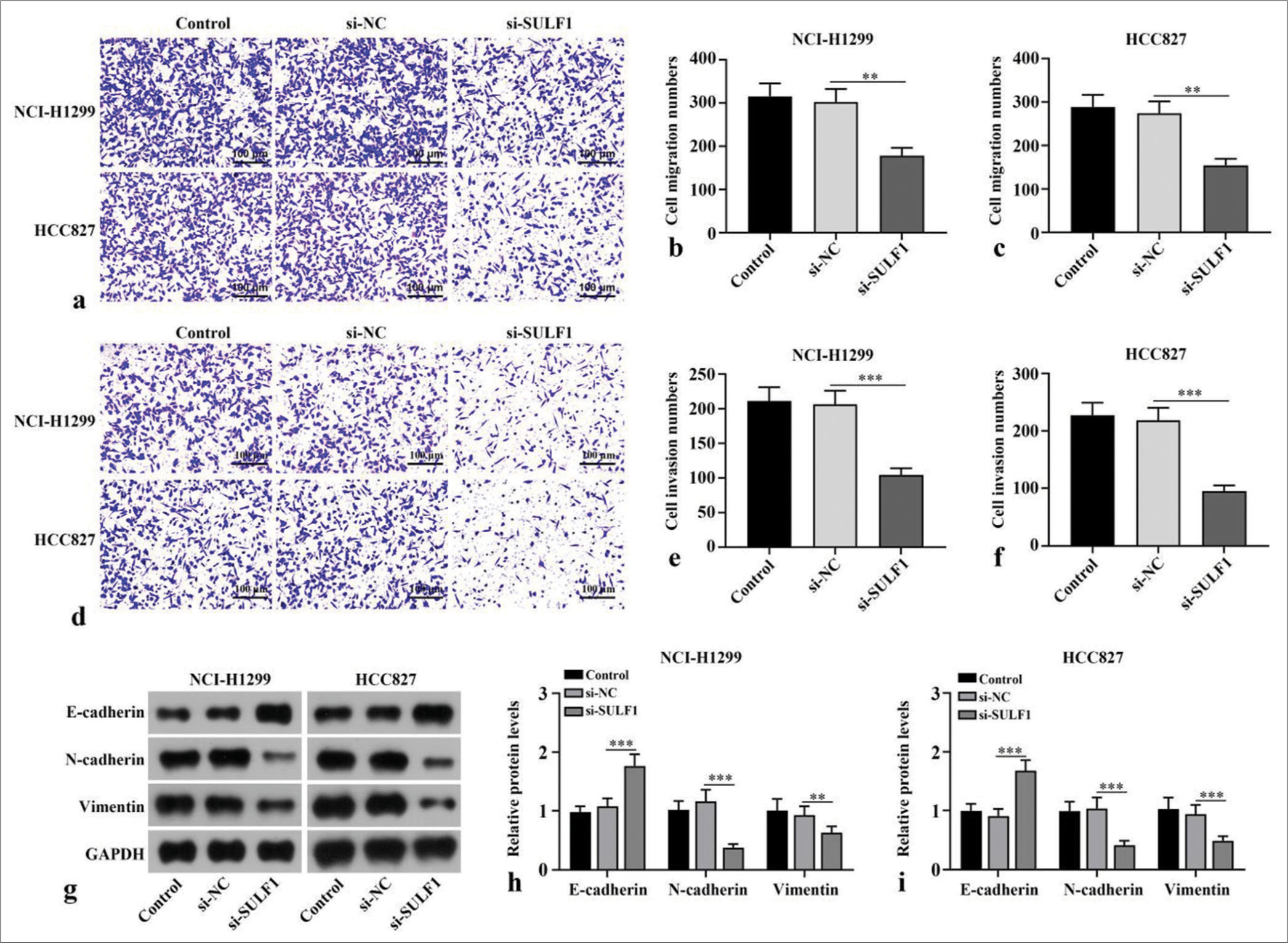 Knockdown of SULF1 abated migration, invasion, and EMT in NSCLC cells. (a-f) Cell migration (a-c) and invasion (d-f) measured with Transwell assay, n = 3. (g-i) EMT-related biomarkers levels detected through Western blot, n = 3. (**P < 0.01, ***P < 0.001. NSCLC: Non-small cell lung cancer, SULF1: Sulfatase 1, si-NC: Negative control, si-SULF1: siRNA SULF1, EMT: Epithelial-to-mesenchymal transition).