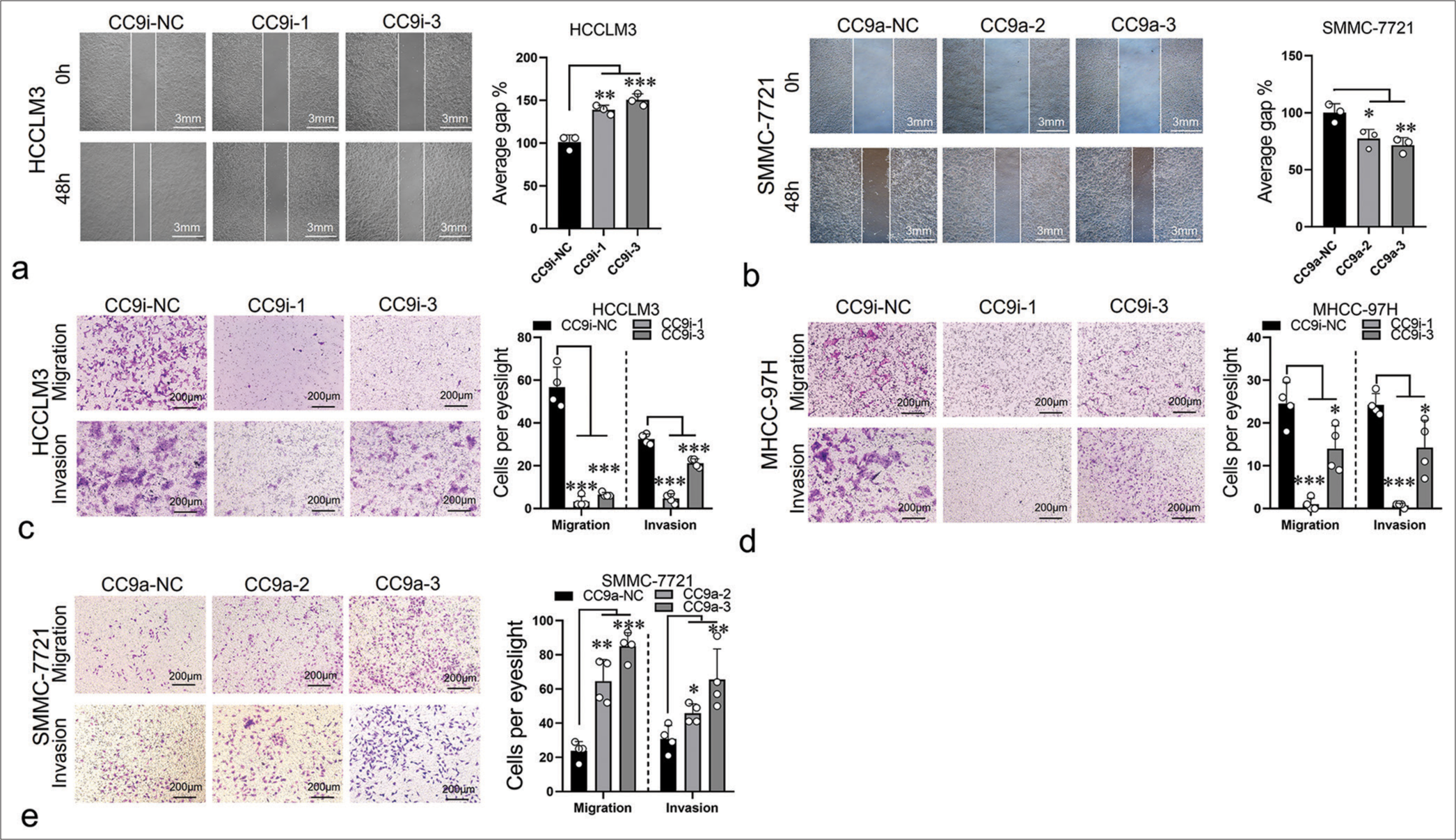 ST8SIA6-AS1 promotes the migration and invasion of HCC cells in vitro. (a) Compared with the control group (CC9i-NC), the knockdown of ST8SIA6-AS1 (CC9i-1 and CC9i-3) decreased the migration capacity of HCCLM3. (b) Compared with the control group (CC9a-NC) the overexpression of ST8SIA6-AS1 (CC9a-2 and CC9a-3) enhanced the migration ability of SMMC-7721. (c-e) Cell migration and invasion capacity of HCCLM3, MHC-97H (c and d), and SMMC-7721 (e) were measured by Transwell migration and Matrigel invasion assays. The asterisk indicates that the data have statistical differences, *P < 0.05, **P < 0.01, and ***P < 0.001. (ST8SIA6-AS1: ST8SIA6 antisense RNA 1, HCC: Hepatocellular carcinoma, NC: Negative control, CC9a: Crispr-Cas9-based gene activation, CC9i: Crispr-Cas9-based gene interference.)