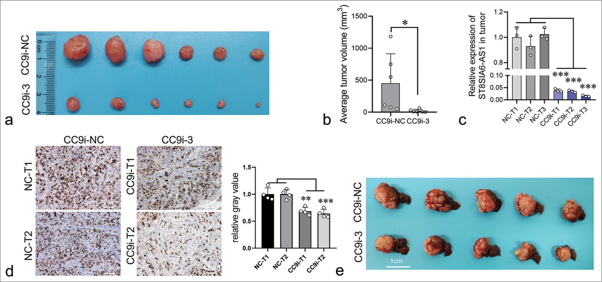 ST8SIA6-AS1 knockdown significantly reduces the growth of liver tumors in vivo. (a and b). The tumor volume of subcutaneous xenografts in nude mice injected with the HCCLM3 cells. (c) ST8SIA6-AS1 expression level was determined in the tumors of the control and ST8SIA6-AS1 knockdown groups at the end of the experiment. NC-T1, NC-T2, and NC-T3 refer to three randomly selected tumor tissues in the control group. CC9i-T1, CC9i-T2, and CC9i-T3 refer to three randomly selected tumor tissues in the ST8SIA6-AS1 knockdown group. (d) Ki67 immunohistochemical staining in xenograft tumor sections. (e) The knockdown of ST8SIA6-AS1 expression decelerated the growth of liver tumors in situ (tumor and sections of liver tissue). CC9i-NC: Control group; CC9i-3: Experimental group 3. Error bars, mean ± s.e.m. Data were analyzed with ANOVA. The asterisk indicates that the data have statistical differences, *P < 0.05, **P < 0.01, and ***P < 0.001. (ST8SIA6-AS1: ST8SIA6 antisense RNA 1, NC: Negative control, CC9i: Crispr-Cas9-based gene interference, S.E.M.: Standard error of the mean, ANOVA: Analysis of variance.)