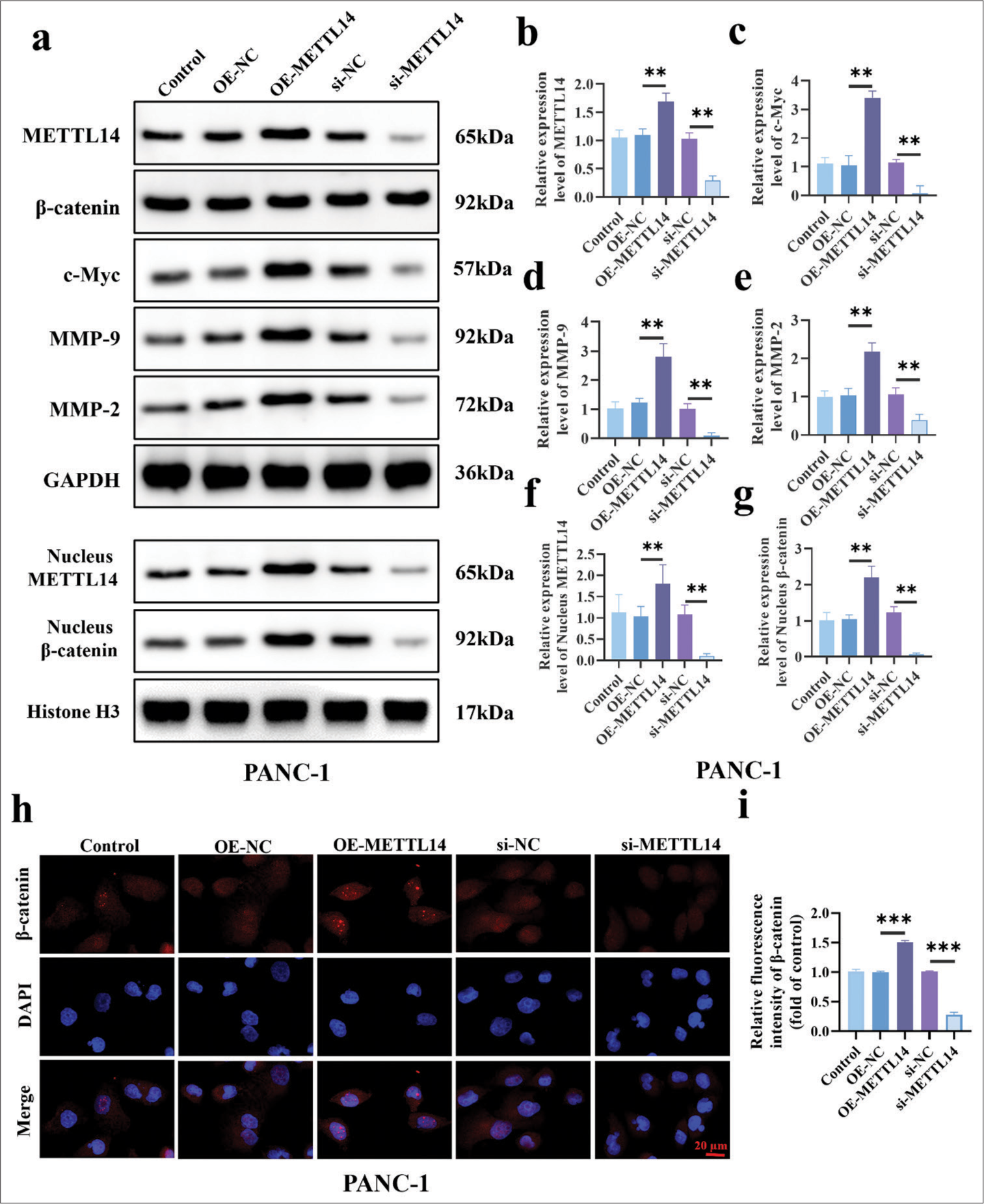 METTL14 promotes c-Myc expression and nucleus b-catenin expression in vitro. (a) Western blot results of METTL14, c-Myc, b-catenin, MMP-9, and MMP-2 in PANC-1. (b-g) Relative protein expression of METTL14, c-Myc, b-catenin, MMP-9, and MMP-2 in PANC-1. (hi) b-catenin immunofluorescence assay. Objective: 200×. n = 3, **P < 0.01, ***P < 0.001. (c-Myc: Myc proto-oncogene, MMP: Matrix metalloproteinase, METTL14, methyltransferase-like 14, DAPI: 4’,6-diamidino-2-phenylindole, GAPDH: Glyceraldehyde-3-phosphate dehydrogenase).