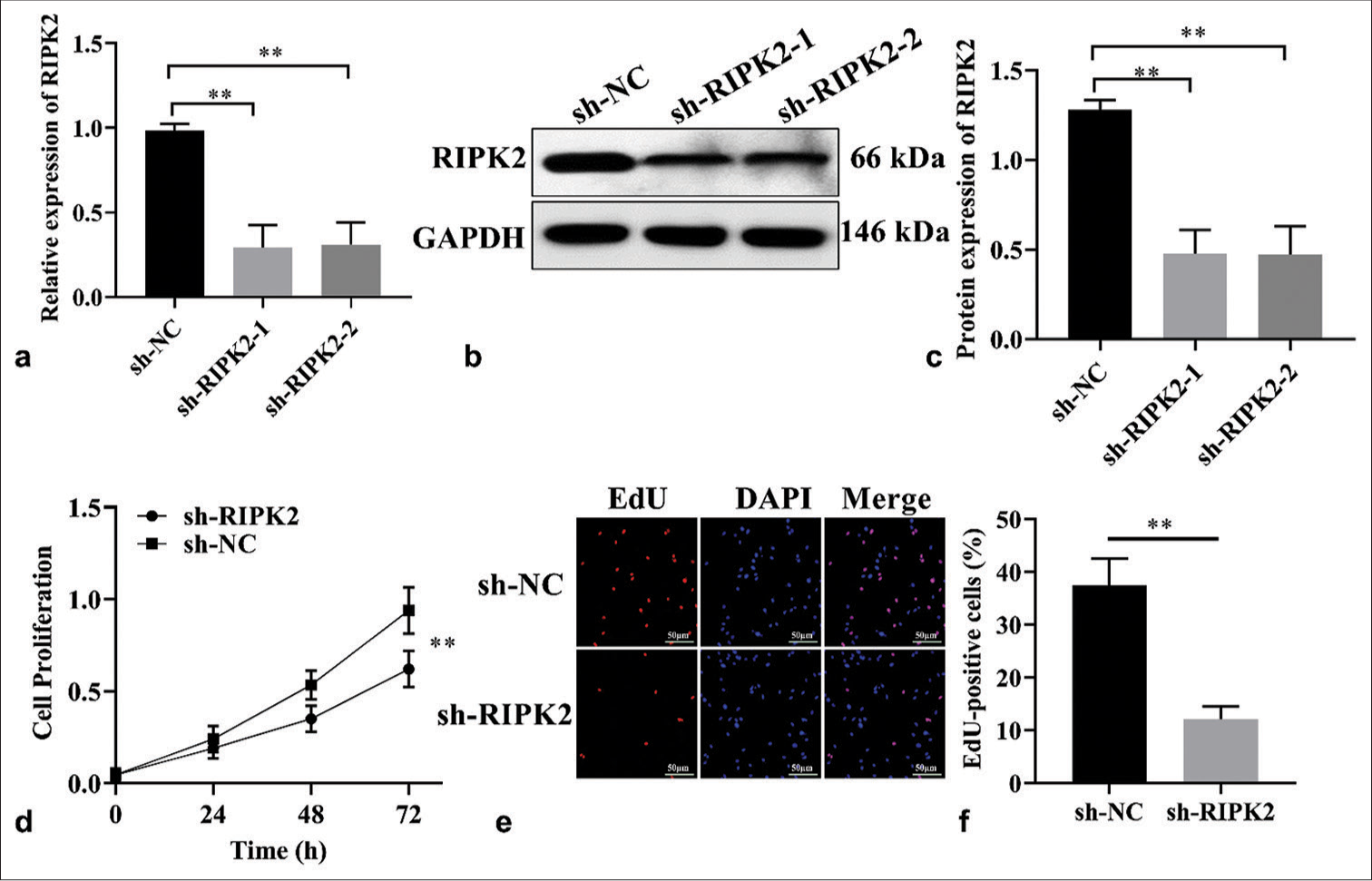 RIPK2 knockdown suppresses cell proliferation. (a-c) Analysis of RIPK2 expression in shRIPK2 RA-FLS by RT-qPCR and WB (n = 3). (d) The growth of sh-RIPK2 RA-FLS was suppressed (n = 3). (e and f) EdU assay showed that cell proliferation was reduced upon RIPK2 silencing in RAFLS cells (n = 3). (**P < 0.01. EdU: 5-ethynyl-2'-deoxyuridine, GAPDH: Glyceraldehyde 3-phosphate dehydrogenase, DAPI: 4', 6-diamidino-2-phenylindole, RIPK2: Receptor interacting serine/threonine kinase 2, NC: Negative control, RA-FLS: Rheumatoid arthritis-fibroblast-like synoviocytes, RT-qPCR: Real-time quantitative polymerase chain reaction, WB: Western blot.).