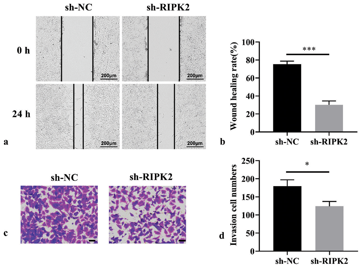 RIPK2 knockdown suppresses the migration and invasion of RA-FLS. (a and b) Cell migration ability of RA-FLS suppressed by RIPK2 knockdown as analyzed by wound healing assay (n = 3). (c and d) Cell invasion ability of RA-FLS suppressed by RIPK2 as analyzed by transwell assay (n = 3, scale bar: 50 μm). (*P < 0.05, ***P < 0.001. RIPK2: Receptor interacting serine/threonine kinase 2, NC: Negative control, RA-FLS: Rheumatoid arthritis-fibroblast-like synoviocytes.).