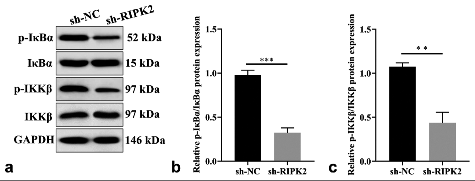 RIPK2 silencing regulates the NF-κB pathway in RA-FLS cells. (a-c) The level of p-IκBα/IκBα and p-IKKβ/IKKβ was detected by WB (n = 3). (**P < 0.01; ***P < 0.001. p-IκBα: Phosphorylated inhibitor of kappa B alpha, p-IKKβ: Phosphorylation of IkappaB kinase beta, NF-κB: Nuclear factor kappa B, RIPK2: Receptor interacting serine/threonine kinase 2, NC: Negative control, RA-FLS: Rheumatoid arthritis-fibroblast-like synoviocytes, WB: Western blot).