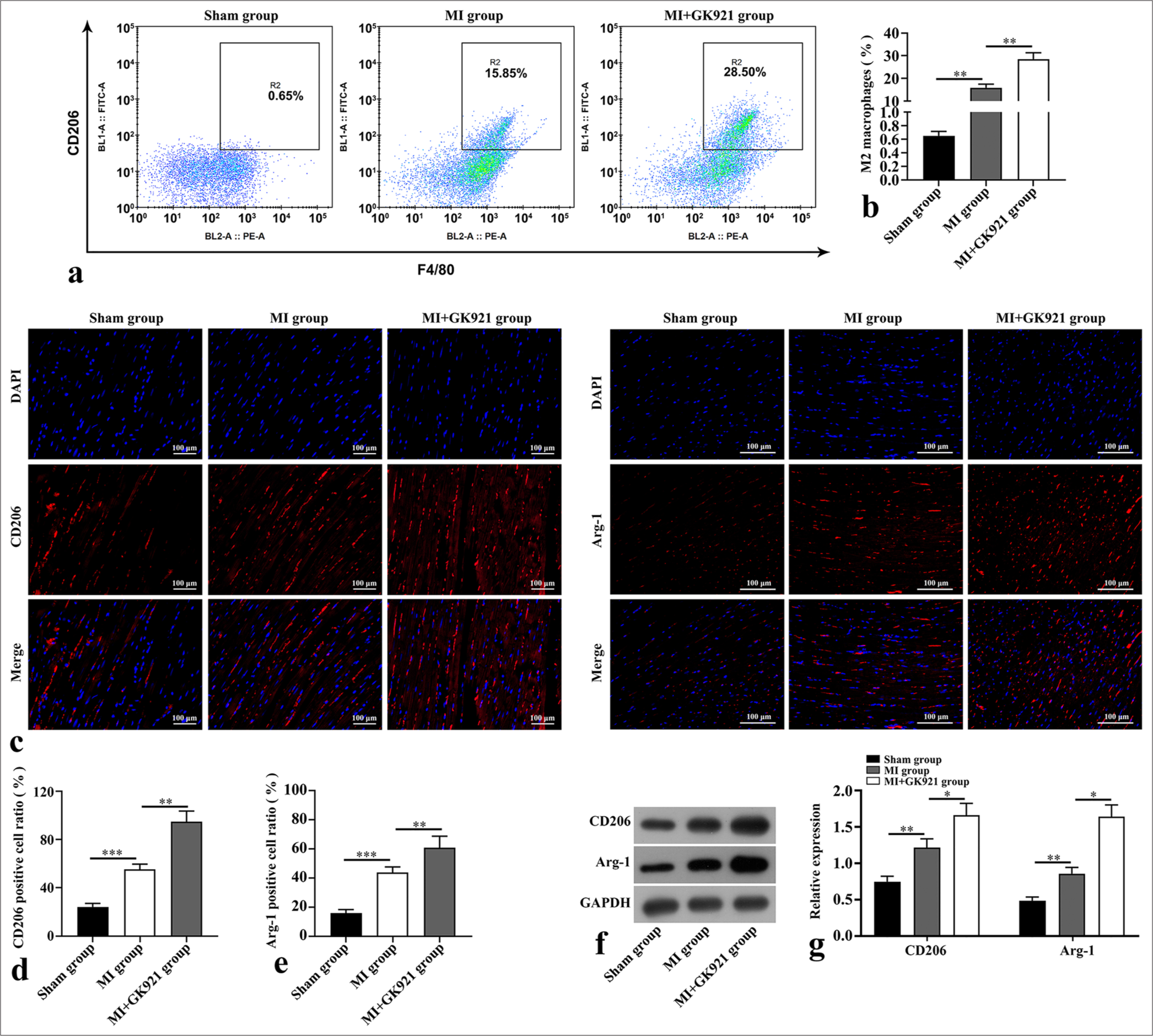 Transglutaminase 2 inhibition promoted M2 macrophage polarization in mice after myocardial infarction (MI). (a and b) Flow cytometry was performed to assess myocardial epidermal growth factor-like module-containing mucin-like hormone receptor-like 1 (F4/80)+ macrophage mannose receptor (CD206)+ macrophages (n = 3). (c-e) Immunofluorescence staining of M2 macrophage polarization markers in mouse heart tissues (n = 3). Scale bar, 100 µm. The CD206 and arginase-1 (Arg-1) staining exhibits red fluorescence, and 4’,6-diamidino-2-phenylindole (DAPI) staining for labeling cell nuclei shows blue fluorescence. (f and g) Protein expressions of CD206 and Arg-1 in mouse heart tissues were detected using Western blot (n = 3). (*P < 0.05, **P < 0.01, and ***P < 0.001. DAPI: 4’,6-diamidino-2-phenylindole, GAPDH: Glyceraldehyde-3-phosphate dehydrogenase.)