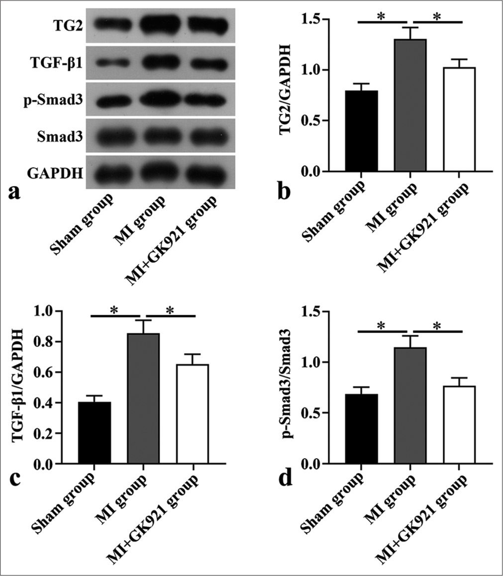 Transglutaminase 2 inhibition suppressed the transforming growth factor (TGF)-β1/Small mother against decapentaplegic 3 (Smad3) pathway in myocardial infarction (MI) mice. (a) Transglutaminase 2 (TG2), TGF-β1, phosphoSmad3 (p-Smad3), and Smad3 protein expression measured in mouse heart tissues via Western blot (n = 3). (b - d) Quantitative analysis of TG2, TGF-β1, p-Smad3/Smad3 (n = 3). (*P < 0.05. GAPDH: Glyceraldehyde-3-phosphate dehydrogenase.)