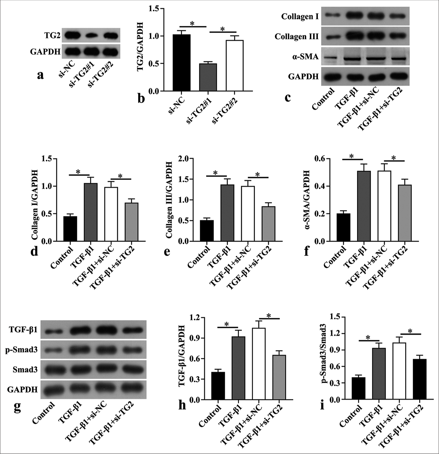 Transglutaminase 2 downregulation transforming growth factor (TGF)-β1-induced myocardial fibrosis and repressed TGF-β1/small mother against decapentaplegic 3 (Smad3) pathway in mouse cardiac fibroblasts. (a and b) Small interfering negative control (si-NC) and siTransglutaminase 2 (si-TG2) were transfected to mouse cardiac fibroblasts isolated from C57BL/6 mice, and the protein expression of TG2 was detected through Western blot. (c-f) Mouse cardiac fibroblasts were treated with 100 µg/mL TGF-β1 to induce fibrosis, followed by transfection with siNC and si-TG2 for 48 h. Western blot was conducted to determine the levels of fibrosis-associated proteins, including collagen I, collagen III, and α-smooth muscle actin (α-SMA), in mouse cardiac fibroblasts after TGF-β1 treatment and transfection (n = 3). (g-i) Western blot was also used in the assessment of the levels of TGF-β1, phospho-Smad3 (p-Smad3), and Smad3 in mouse cardiac fibroblasts after TGF-β1 treatment and transfection (n = 3). (*P < 0.05. GAPDH: Glyceraldehyde-3-phosphate dehydrogenase.)