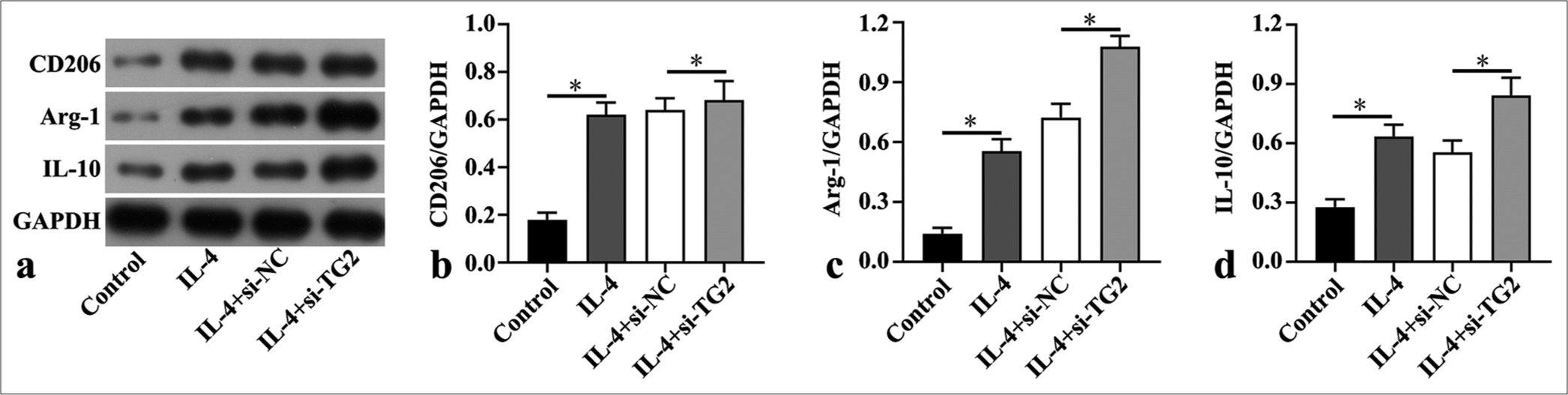 Transglutaminase 2 inhibition increased M2 macrophage polarization in interleukin (IL)-4-induced bone marrow derived macrophages. (a-d) Western blot was utilized to assess the levels of macrophage mannose receptor (CD206), arginase-1 (Arg-1) and interleukin-10 (IL-10) in interleukin (IL)-4-induced bone marrow derived macrophages after transfection of small interfering negative control (si-NC) and si-Transglutaminase 2 (si-TG2) (n = 3). (*P < 0.05. GAPDH: Glyceraldehyde-3-phosphate dehydrogenase.)