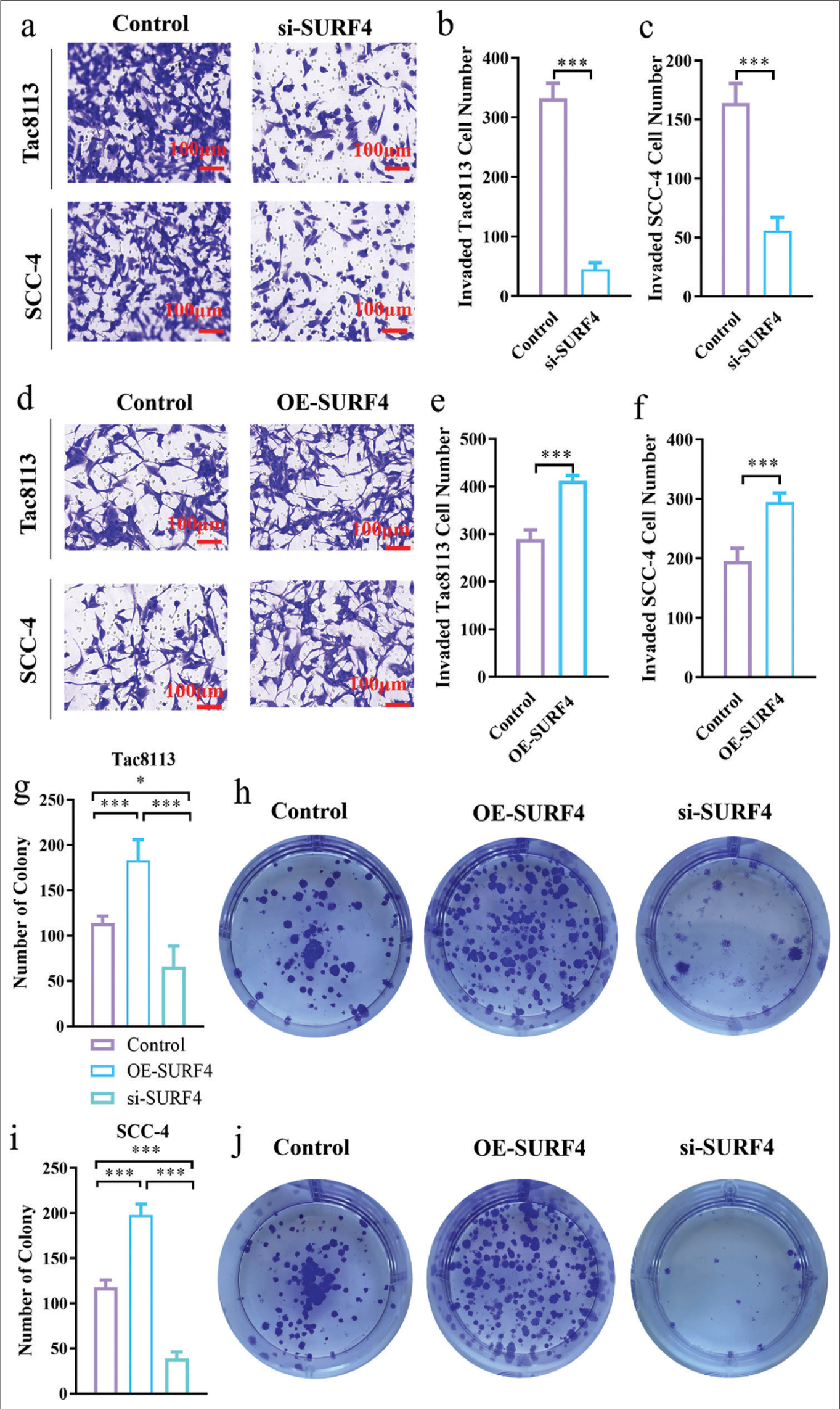 SURF4 regulates the proliferation and invasion abilities of OSCCs. (a) Representative images of Transwell assay of OSCC (scale bar: 100 μm). (b and c) Histogram showing the invaded cell number. (d) Representative images of Transwell assay of OSCC (scale bar: 100 μm). (e and f) Histogram showing the invaded cell number. (g) Histogram showing the number of colonies in Tac8113. (h) Representative images of OSCC colony in Tac8113. (i) Histogram showing the number of colonies in SCC-4. (j) Representative images of OSCC colony in SCC-4. (n = 6 for each group). (*P < 0.05, *** P < 0.001. SURF4: Surfeit 4, OSCC: Oral squamous cell carcinoma, siRNA (SURF4): si-SURF4, OE-SURF4: Overexpression SURF4, OSCC cell lines: Tac8113, SCC-4: Squamous cell carcinoma-4, siRNA: Small interfering RNA.)