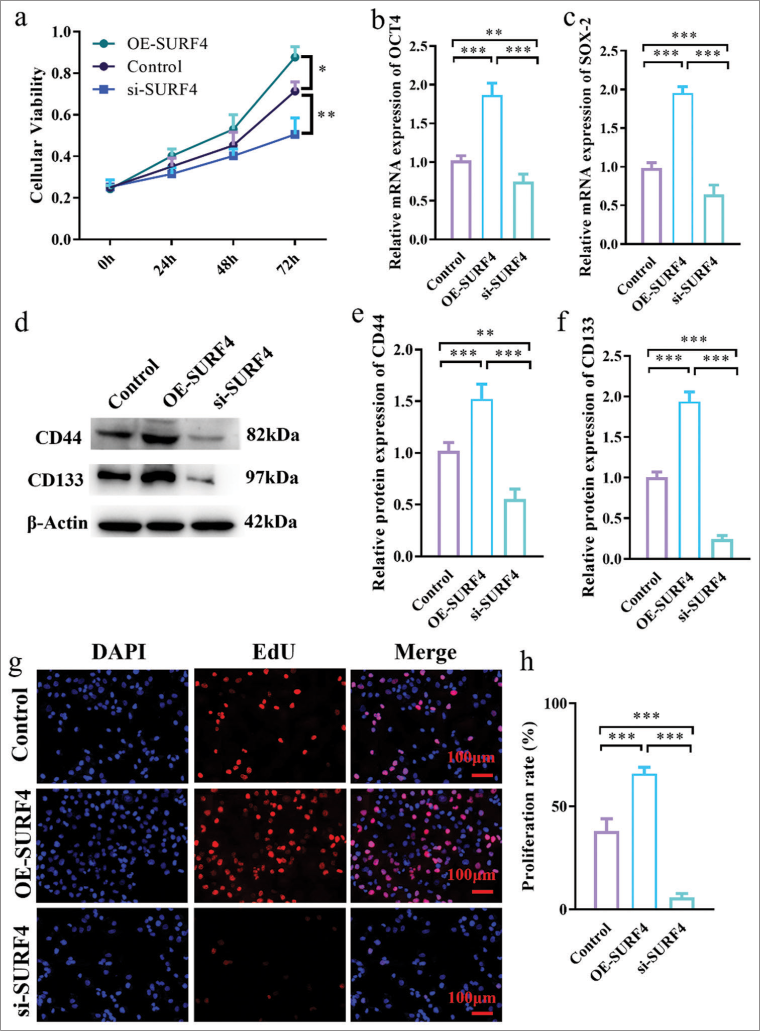 SURF4 aggravates OSCC proliferation and increases the level of stem cell genes OCT-4 and SOX-2. (a) Histogram showing cell viability. (b) Histogram showing the relative OCT-4 mRNA expression level. (c) Histogram showing the relative SOX-2 mRNA expression level. (d) Western blot analysis of the expression of target proteins. (e and f) Histogram showing the target proteins expression level. (g) Representative images of EdU incorporation assay of OSCC in SCC-4 (scale bar: 100 μm). (h) Histogram showing the proliferation rate in SCC-4. (n = 6 for each group). (* P < 0.05; ** P < 0.01; *** P < 0.001. SURF4: Surfeit 4, OSCC: Oral squamous cell carcinoma, siRNA (SURF4): si-SURF4, OE-SURF4: Overexpression SURF4, OCT-4: Octamer-binding transcription factor 4, SOX-4: Sex-determining region Y-box 4, CD44: Cluster of differentiation 44, CD133: Cluster of differentiation 133; b-Actin: Beta-actin, EdU: 5-Ethynyl-2’-deoxyuridine, DAPI: 4’,6-diamidino-2-phenylindole, SCC-4: Squamous cell carcinoma-4, siRNA: Small interfering RNA, mRNA: Messenger RNA.)