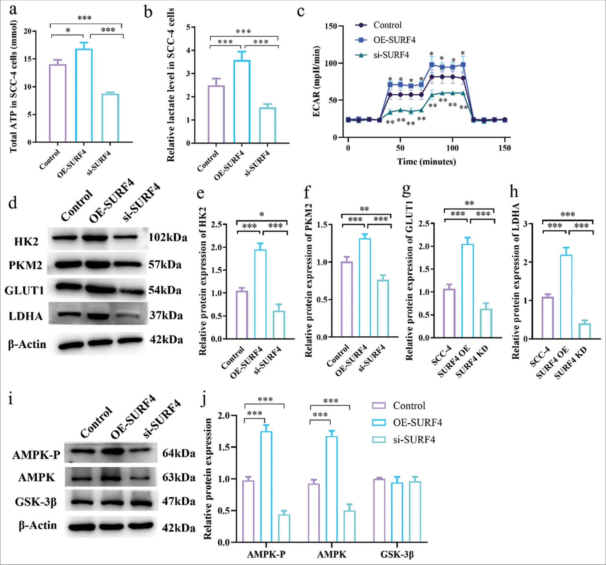 SURF4 impacts OSCC functionality by modulating AG. (a) Histogram showing total ATP (mmol). (b) Histogram showing relative lactate level. (c) Histogram showing ECAR (mpH/min) level. (d) Western blot analysis of the expression of target proteins. (e-h) Histogram showing the expression levels of target proteins. (i) Western blot analysis of the expression of target proteins. (j) Histogram showing the expression levels of target proteins. (n = 6 for each group). (* P < 0.05; ** P < 0.01; *** P < 0.001. SURF4: Surfeit 4, OSCC: Oral squamous cell carcinoma, AG: Aerobic glycolysis, ATP: Adenosine triphosphate, ECAR: Extracellular acidification rate, siRNA (SURF4): si-SURF4, OE-SURF4: Overexpression SURF4, HK2: Hexokinase 2, PKM2: Pyruvate kinase muscle 2, GLUTI: Glucose transporter type 1, LDHA: Lactate dehydrogenase A: AMPK-P: Phosphorylated AMP-activated protein kinase, AMPK: AMP-activated protein kinase, GSK-3b: Glycogen synthase kinase 3 beta, b-Actin: Beta-actin, siRNA: Small interfering RNA.)