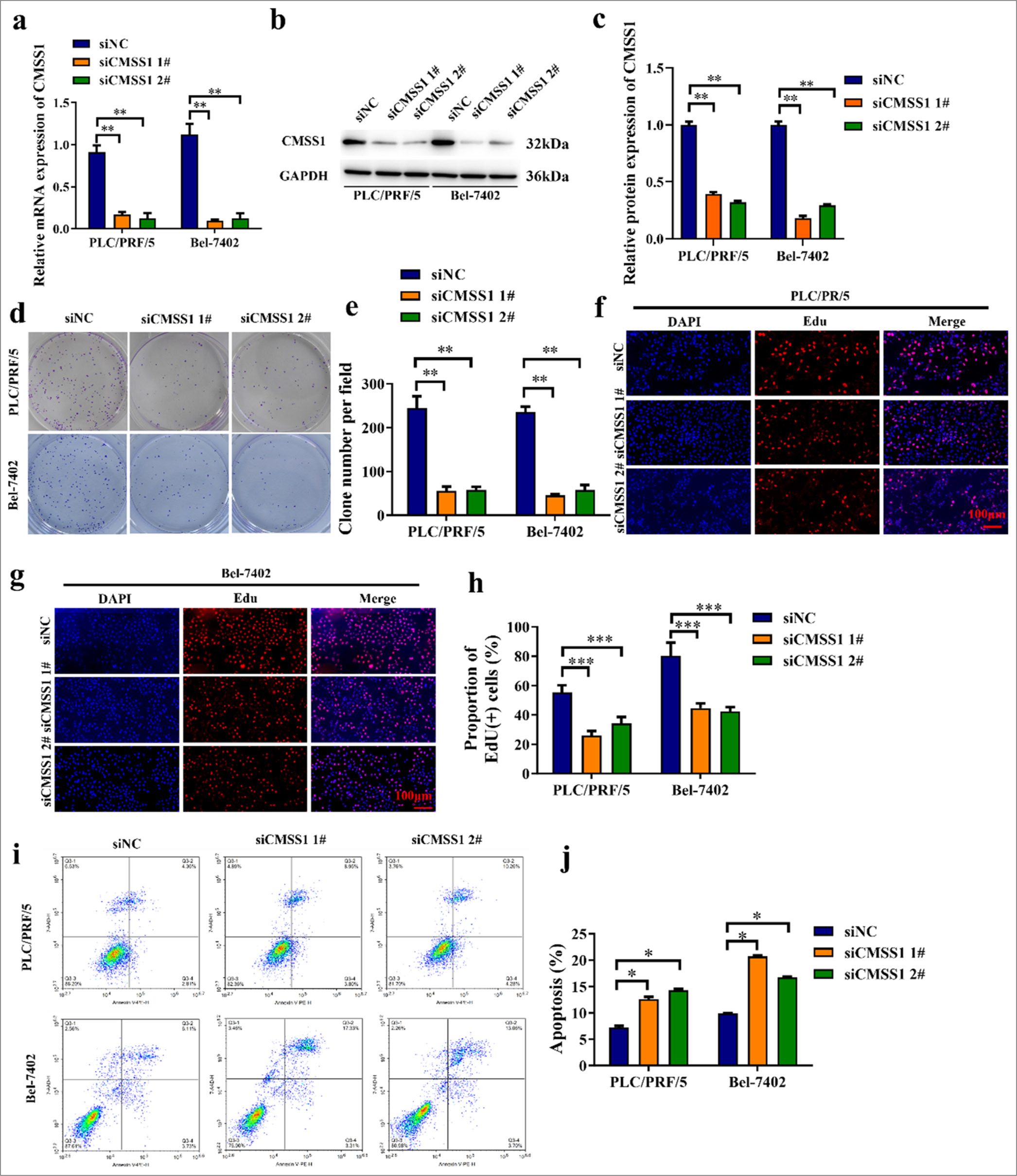 CMSS1 promotes proliferation and inhibits apoptosis in HCC in vitro. (a) Efficiency of CMSS1 siRNA confirmed by qRT-PCR, (b and c) Efficiency of CMSS1 siRNA confirmed by immunoblotting, (d and e) Colony formation assay after silencing CMSS1, (f-h) EdU assay after silencing CMSS1, (i and j) Flow cytometry analysis showing that CMSS1 overexpression increases apoptosis rate whereas CMSS1 deficiency decreases apoptosis rate. n = 3. ✶P < 0.05, ✶✶P < 0.01, ✶✶✶P < 0.001. CMSS1: Cms1 ribosomal small subunit homolog, HCC: Hepatocellular carcinoma, siRNA: Small interfering RNA.