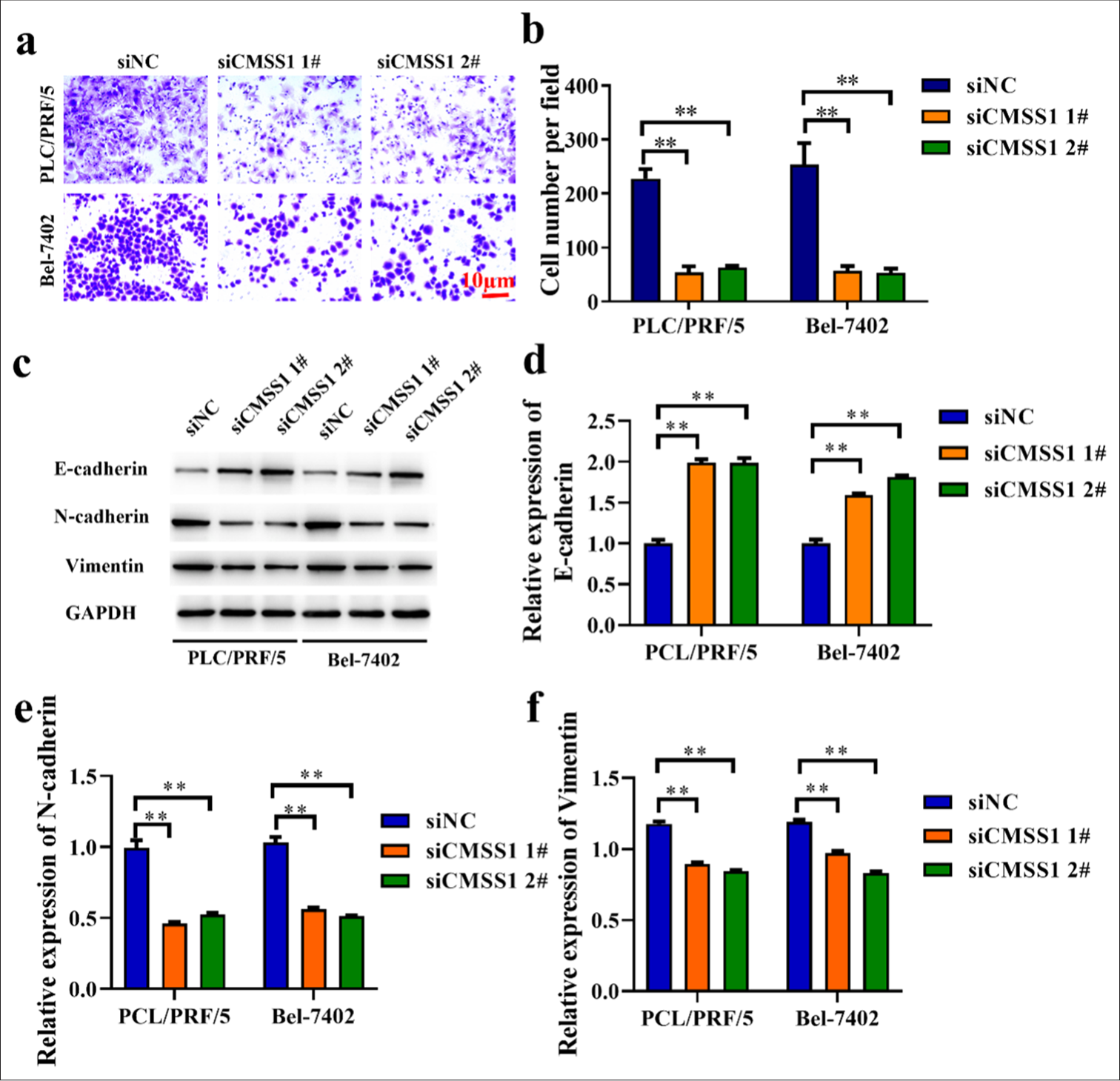 CMSS1 promotes metastasis in HCC. (a and b) Inhibition of PCL/PRF/5 and Bel-7402 cells invasion by silencing CMSS1 expression. (c-f) Expression of EMT-related genes in PCL/PRF/5 and Bel-7402cells evaluated by Western blot after silencing CMSS1. n = 3. ✶✶P < 0.01. CMSS1: Cms1 ribosomal small subunit homolog, HCC: Hepatocellular carcinoma.