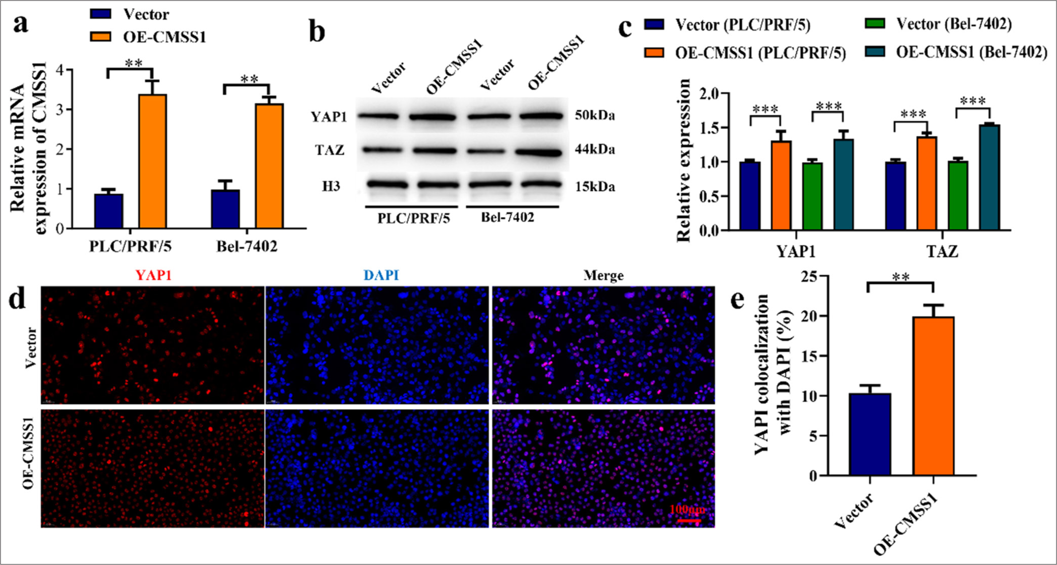 CMSS1 promotes YAP1 nuclear translocation. (a) Transfection efficiency of CMSS1, (b and c) CMSS1 overexpression increases YAP1 and TAZ nuclear translocation, (d) Quantification of YAP1 nuclear localization after overexpression of CMSS1, (e) Immunofluorescence analysis after overexpression of CMSS1. n = 3. ✶✶P < 0.01, ✶✶✶P < 0.001. CMSS1: Cms1 ribosomal small subunit homolog, YAP1: Yes-associated protein 1.