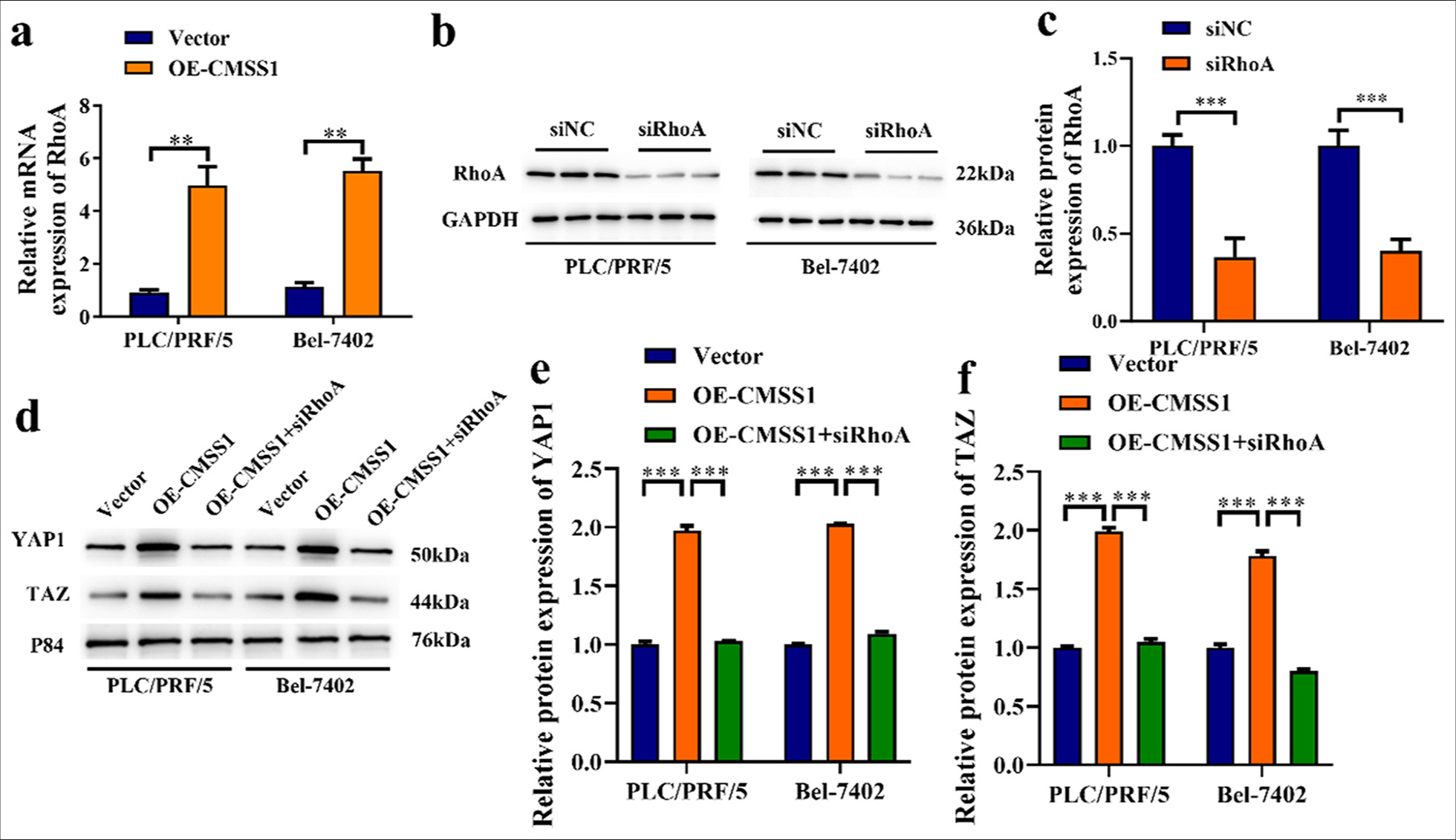 CMSS1 promotes YAP1 signaling pathway activation through RhoA. (a) Overexpression of CMSS1 increases RhoA expression levels. (b and c) Western blot strip and protein level of RhoA after overexpression of CMSS1, (d-f) Silencing RhoA inhibits YAP1 and TAZ nuclear translocation by reducing the Overexpression of CMSS1. n = 3. ✶✶P < 0.01, ✶✶✶P < 0.001. CMSS1: Cms1 ribosomal small subunit homolog, YAP1: Yes-associated protein 1, RhoA: Ras homolog family member A.