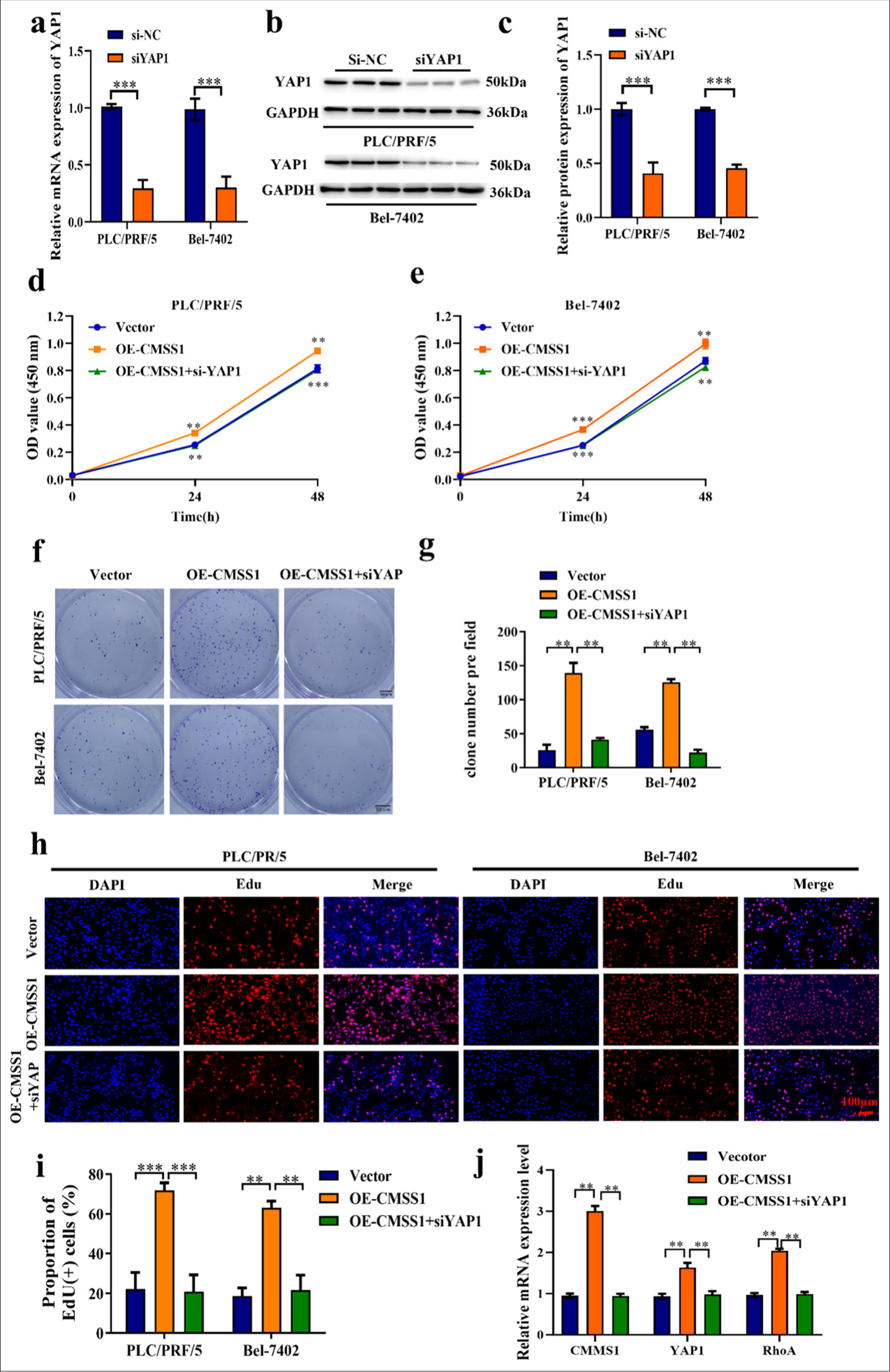 Silencing YAP1 reverses CMSS1-mediated HCC progression. (a) Transfection efficiency of siYAP1, (b) Western blot strip and protein level of YAP1 after silencing YAP1, (c) Relative quantification of YAP1 protein expression after silencing YAP1, (d and e) CCK-8 assay after silencing YAP1, (f and g) Colony formation assay after silencing YAP1, (h and i) EdU analysis after silencing YAP1, (j) Silencing YAP1 inhibits CMSS1 and RhoA mRNA expression. n = 3, ✶✶P < 0.01, ✶✶✶P < 0.001. CMSS1: Cms1 ribosomal small subunit homolog, YAP1: Yes-associated protein 1, RhoA: Ras homolog family member A, HCC: Hepatocellular carcinoma.