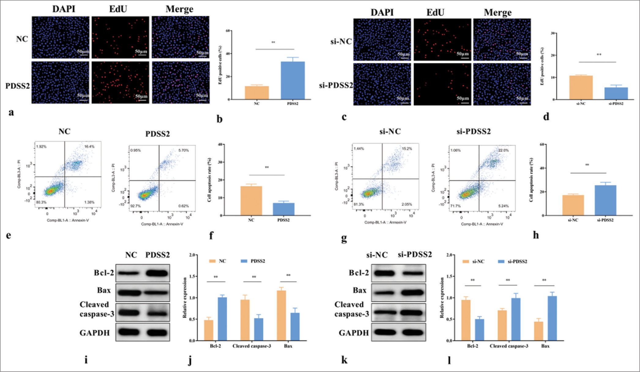 PDSS2 attenuates the apoptosis of Ang II-treated VSMCs. (a) Effects of PDSS2 on the EdU positive rate of Ang II-treated VSMCs. (b) Statistical analysis of EdU positive cell rate. (c) Effects of si-PDSS2 on the EdU positive rate of Ang II-treated VSMCs. (d) Statistical analysis of EdU positive cell rate. (e) Effects of PDSS2 on the apoptosis of Ang II-treated VSMCs. (f) Statistical analysis of cell apoptosis. (g) Effects of si-PDSS2 on the apoptosis of Ang II-treated VSMCs. (h) Statistical analysis of cell apoptosis. (i) Effects of PDSS2 on the levels of Bcl-2, cleaved caspase-3, and Bax in Ang II-treated VSMCs. (j) Statistical analysis of protein expression. (k) Effects of si-PDSS2 on the levels of Bcl-2, cleaved caspase-3, and Bax in Ang II-treated VSMCs. (l) Statistical analysis of protein expression. ✶✶P < 0.01, n = 3. PDSS2: Prenyl diphosphate synthase subunit 2, VSMCs: Vascular smooth muscle cells, Ang II: Angiotensin II, EdU: 5-ethynyl-2'-deoxyuridine, DAPI: 4’,6-diamidino-2-phenylindole, si-NC: Small interfering RNA negative control, NC: Negative control, GAPDH: Glyceraldehyde-3-phosphate dehydrogenase, Bcl-2: B-cell lymphoma 2, Bax: BCL2-associated X protein.