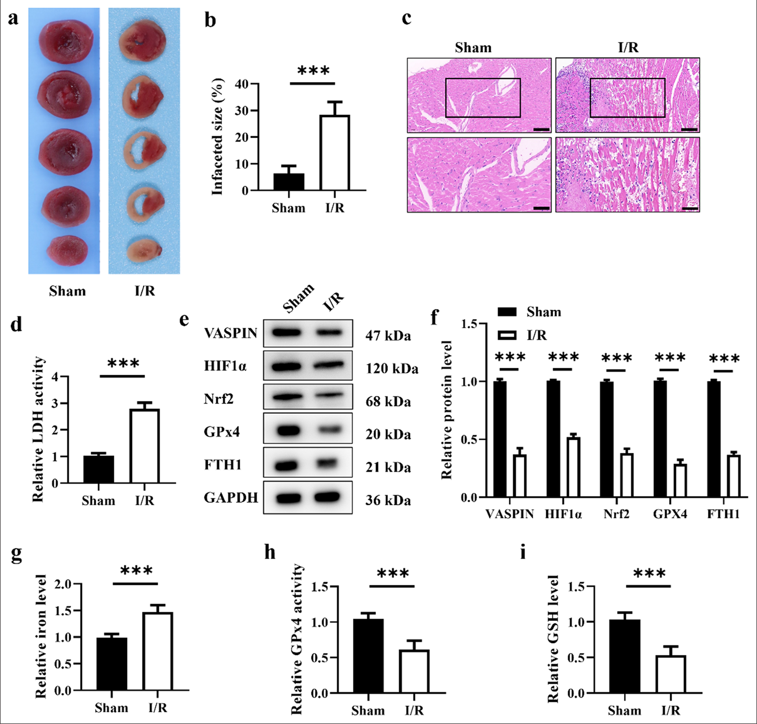 Myocardial ischemia/reperfusion (I/R) induces ferroptosis and reduces the expression levels of vaspin. (a) Representative triphenyltetrazolium chloride staining images of myocardial sections. (b) Quantitative analysis of myocardial infarct size. (c) Hematoxylin-eosin staining of myocardial sections. Scale bar = 200 μm. Scale bar = 100 μm (enlarged view). (d) Relative lactate dehydrogenase activity in the sham and I/R groups. (e and f) Western blot analysis of vaspin, hypoxia-inducible factor-1α (HIF1α), nuclear respiratory factor 2 (Nrf2), glutathione peroxidase 4 (GPx4), and FTH1 in the sham and I/R groups. (g) Relative cellular iron levels. (h) Relative GPx4 activity in the sham and I/R groups. (i) Relative cellular glutathione levels. Results were presented as mean ± standard deviation. n = 6; ✶✶✶P < 0.001. FTH1: Ferritin heavy chain 1; GAPDH: Glyceraldehyde 3-phosphate dehydrogenase.