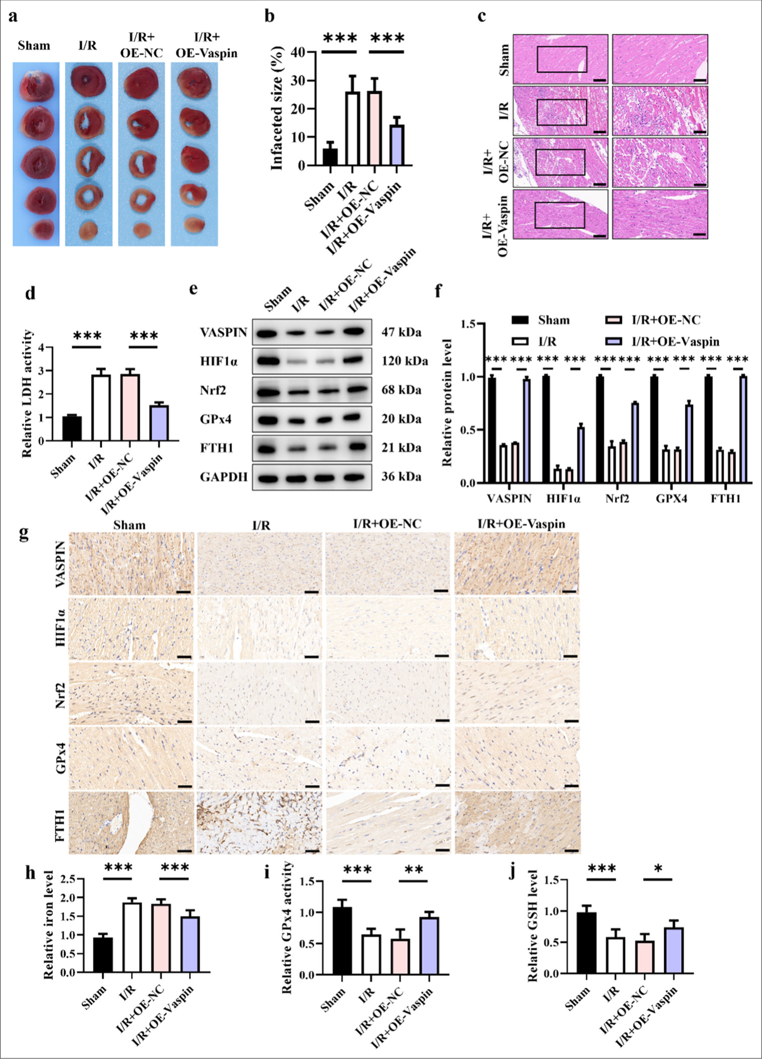 Overexpression of vaspin reduces H/R-induced myocardial I/R injury in mice. (a) Representative triphenyltetrazolium chloride staining images. (b and c) Hematoxylin-eosin staining and quantitative analysis of myocardial infarct size. Scale bar = 200 μm. (d) Relative lactate dehydrogenase activity in each group. (e and f) Western blot analysis of Vaspin, hypoxia-inducible factor-1α (HIF1a), nuclear respiratory factor 2 (Nrf2), glutathione peroxidase 4 (GPx4), and FTH1. (g) Immunohistochemical analysis of Vaspin, HIF1a, Nrf2, GPx4, and FTH1. Scale bar = 200 μm. (h) Relative cellular iron levels. (i) Relative GPx4 activity. (j) Relative cellular glutathione levels. The results were presented as the mean ± standard deviation. n = 6; ✶P < 0.05, ✶✶P < 0.01, ✶✶✶P < 0.001. OE-NC: Negative control to OE-vaspin, GAPDH: Glyceraldehyde 3-phosphate dehydrogenase, FTH1: Ferritin heavy chain 1.