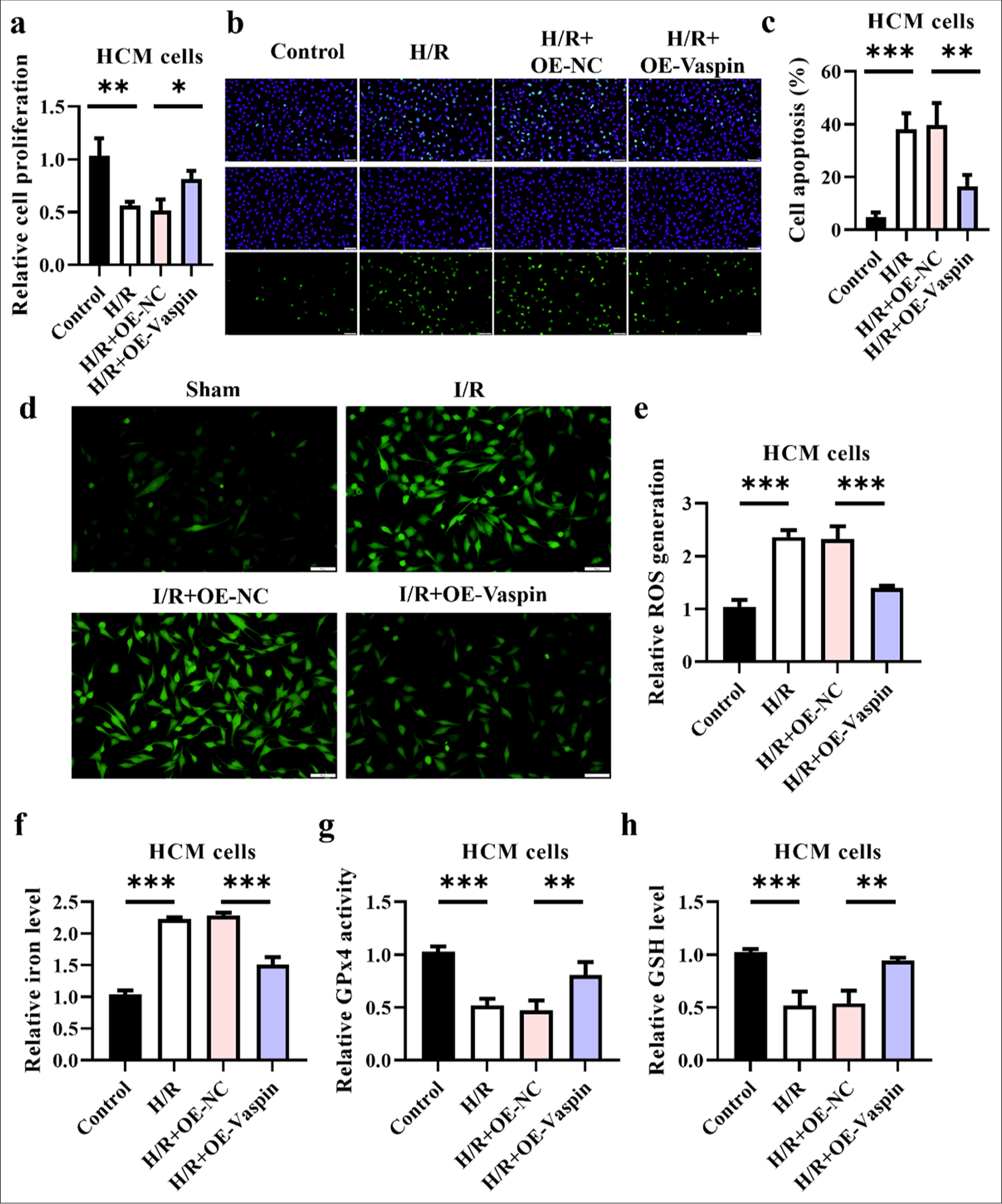 Overexpression of vaspin inhibits hypoxia/reoxygenation (H/R)-induced damage at the cellular level. (a) Cell viability under H/R treatment was assessed by cell counting kit-8 assay in transfected cells. (b and c) Apoptosis under H/R treatment assessed by terminal deoxynucleotidyl transferase-mediated dUTP nick end labeling assay in transfected cells. Scale bar = 200 μm. (d and e) Fluorescence staining to measure the relative cellular reactive oxygen species levels. Scale bar = 50 μm. (f) Relative cellular iron levels. (g) Glutathione peroxidase 4 activity in each group. (h) Glutathione levels. The results were presented as the mean ± standard deviation. n = 3; ✶✶P < 0.01, ✶✶✶P < 0.001.