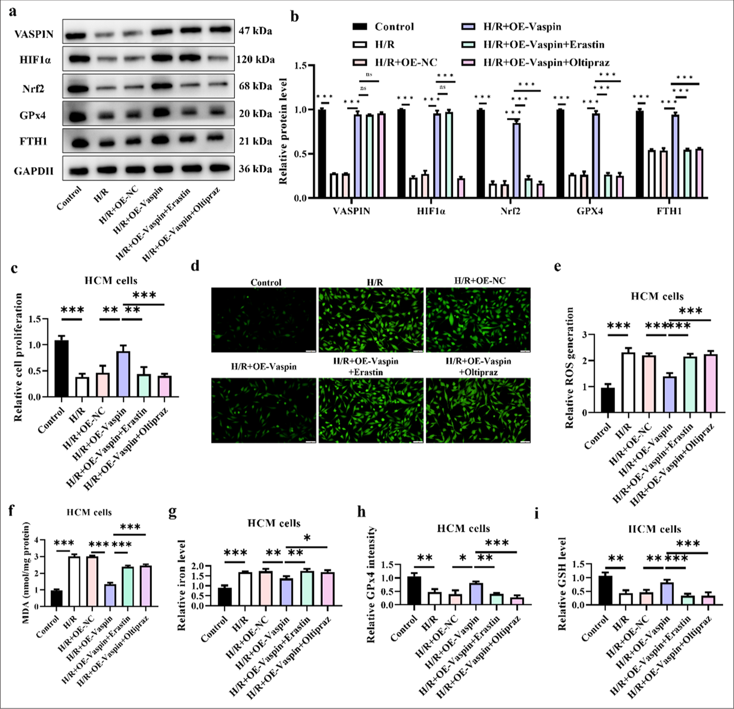 Ferroptosis inducer (Erastin) and hypoxia-inducible factor-1α (HIF1α) inhibitor (Oltipraz) reverse the protective effects of vaspin on myocardium. Myocardial cells were pre-treated with Erastin (5 μM) or Oltipraz (10 μM) for 24 h before hypoxia/reoxygenation (H/R) treatment. (a and b) Vaspin and ferroptosis-related protein expression levels in transfected cells after H/R treatment. (c) Cell viability under H/R treatment was assessed by cell counting kit-8 assay in transfected cells. (d and e) Fluorescence staining to measure the relative cellular reactive oxygen species levels. Scale bar = 100 μm. (f) Relative malondialdehyde levels. (g) Relative cellular iron levels. (h) Glutathione peroxidase 4 intensity in each group. (i) Glutathione levels. The results were presented as mean ± standard deviation. n = 3; ✶P < 0.05, ✶✶P < 0.01, ✶✶✶P < 0.001.