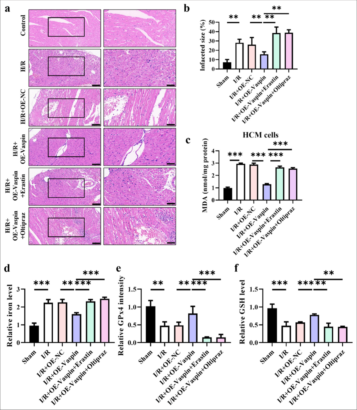 Animal model confirms that ferroptosis inducer (erastin) and HIF1α (oltipraz) reverse the protective effects of Vaspin on myocardium. (a and b) Hematoxylin-eosin staining and quantitative analysis of myocardial infarct size, evaluated by. Scale bar = 200 μm. (c) Relative malondialdehyde levels. (d) Relative cellular iron levels in cardiac tissues. (e) glutathione peroxidase 4 intensity in cardiac tissues. (f) glutathione levels in cardiac tissues. The results were presented as mean ± standard deviation. n = 6; ✶✶P < 0.01, ✶✶✶P < 0.001.