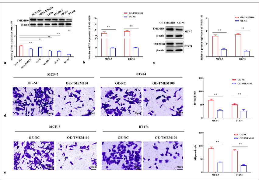 TMEM100 prohibited the invasiveness and migration in breast cancer. (a) Relative protein expression of TMEM100. (b) RT-qPCR and (c) Western blot were used to detect the efficiency of TMEM100 overexpression. Transwell assay manifested that the overexpression of TMEM100 prohibited (d) cell invasiveness and (e) cell migration. ✶✶ P < 0.01, n = 3. TMEM100: Transmembrane protein 100, RT-qPCR: Real-time quantity polymerase chain reaction, OE-NC: Overexpressing negative control, OE-TMEM100: Overexpressing TMEM100.