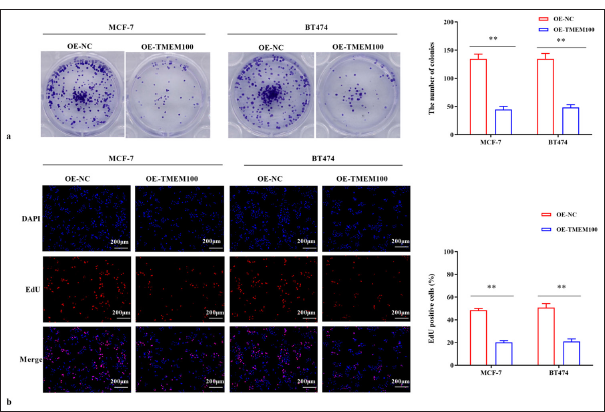 TMEM100 prohibited the cell proliferation in breast cancer. (a) Cell colony-formation assay verified that TMEM100 overexpression decreased the number of cell clones. (b) EdU assay showed that TMEM100 overexpression decreased the EdU-positive cell rate. ✶✶ P < 0.01, n = 3. TMEM100: Transmembrane protein 100, EdU: 5-Ethynyl-2-deoxyuridine, OE-NC: Overexpressing negative control, DAPI: 4’,6-diamidino-2-phenylindole.