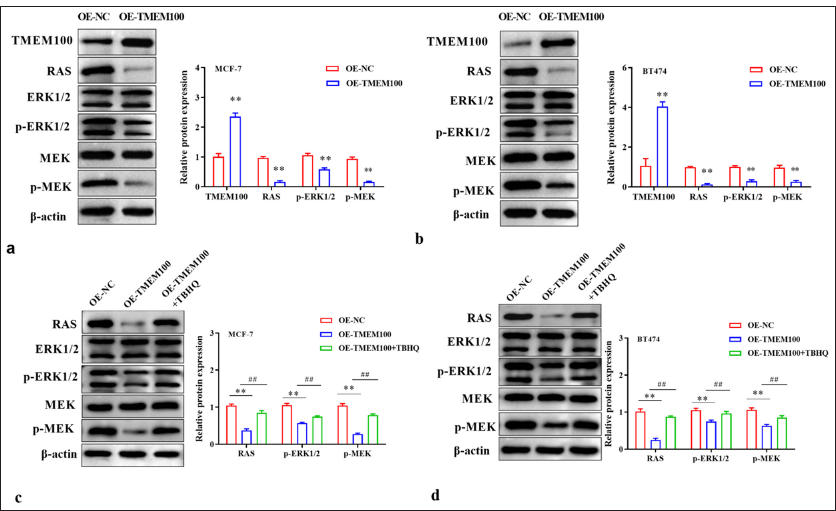 TMEM100 modulated the RAS/ERK pathway. Effects of TMEM100 overexpression on RAS/ERK pathway-related protein expression in (a) MCF-7 cells and (b) BT474 cells were evaluated by Western blot assay. Effects of TMEM100 overexpression and TBHQ on RAS/ERK pathway-related protein expression in (c) MCF-7 cells and (d) BT474 cells were examined by Western blot assay. ## P < 0.01, versus OE-TMEM100 group; ✶✶ P < 0.01, versus OE-NC group, n = 3. TMEM100: Transmembrane protein 100, RAS/ERK: RAS-extracellular signal-regulated kinase, TBHQ: Tert-Butylhydroquinone OE-NC: Overexpressing negative control, OE-TMEM100: Overexpressing TMEM100.