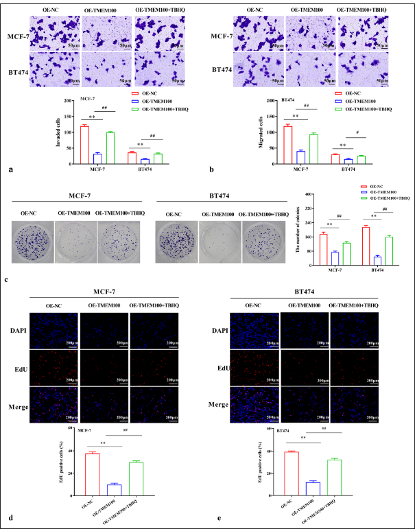 Inhibitory effect of TMEM100 was related to the inactivation of the RAS/ERK pathway. (a) Transwell assay demonstrated that TBHQ reversed the decline in cell invasiveness caused by TMEM100. (b) Transwell assay manifested that TBHQ reversed the decline in cell migration caused by TMEM100. (c) Cell colony-formation assay showed that TBHQ reversed the decrease in the number of cell clones caused by TMEM100. (d, e) EdU assay exhibited that TBHQ reversed the decline in EdU-positive cell rate. # P < 0.05, ## P < 0.01, versus OE-TMEM100 group; ✶✶ P < 0.01, versus OE-NC group, n = 3. TMEM100: Transmembrane protein 100, RAS/ERK: RAS-extracellular signal-regulated kinase, TBHQ: Tert-Butylhydroquinone, OE-NC: Overexpressing negative control, DAPI: 4’,6-diamidino-2-phenylindole, EdU: 5-ethynyl-2′-deoxyuridine.