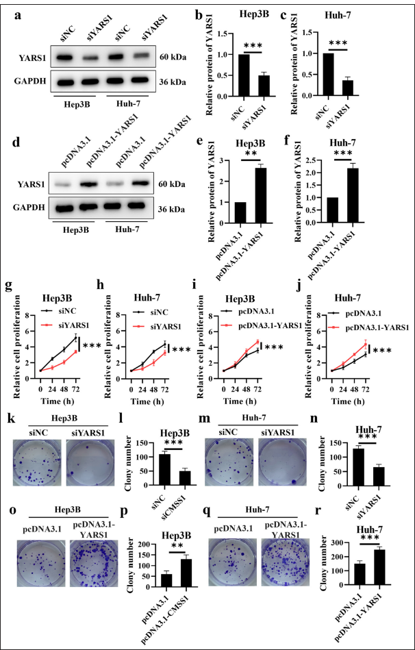 Tyrosyl-tRNA synthetase 1 (YARS1) enhances cell proliferation of Hepatocellular carcinoma in vitro. (a-f) Western blot analysis was performed on YARS1 in Hep3B and Huh-7 cells following transfection with specified plasmids. (g-j) Proliferation rate of Hep3B and Huh-7 cell transfection of indicated plasmids. (k-r) Representative photographs and statistical quantification of colony in Hep3B and Huh-7 cell transfection of indicated plasmids. n = 3. ✶✶ P < 0.01, ✶✶✶ P < 0.001. GAPDH: Glyceraldehyde-3-phosphate dehydrogenase.