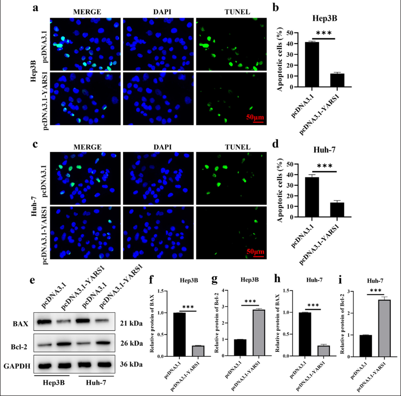 Tyrosyl-tRNA synthetase 1 inhibits cell apoptosis of Hepatocellular carcinoma in vitro. (a-d) Representative photographs and statistical quantification of apoptosis of Hep3B and Huh-7 cell transfection of indicated plasmids. (e-i) Western blot tests were conducted on bax and Bcl-2 proteins in Hep3B and Huh-7 cells after transfection with specified plasmids. n = 3. ✶✶✶ P < 0.001. DAPI: 4’,6-diamidino-2-phenylindole, GAPDH: Glyceraldehyde-3-phosphate dehydrogenase, Bcl-2: B-cell lymphoma 2, Bax: BCL2-associated X protein, TUNEL: Terminal deoxynucleotidyl transferase dUTP nick end labeling.