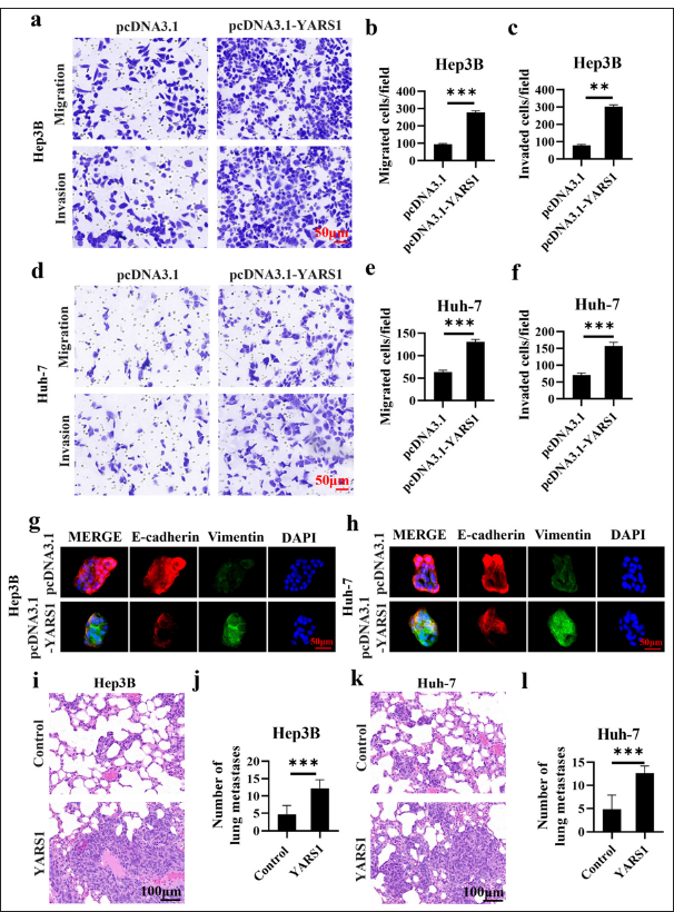 Tyrosyl-tRNA synthetase 1 (YARS1) promoted migration and invasion of Hepatocellular carcinoma. (a-f) Representative photographs and statistical quantification of migration and invasion of indicated plasmids. (g and h) E-cadherin and vimentin in Hep3B and Huh-7 cell transfection of indicated plasmids. (i-l) After YARS1 overexpression, Hep3B and Huh-7 tumor cells were injected via the tail vein, and the ability to form lung metastases was assessed by hematoxylin–eosin staining. n = 3. ✶✶ P < 0.01, ✶✶✶ P < 0.001.