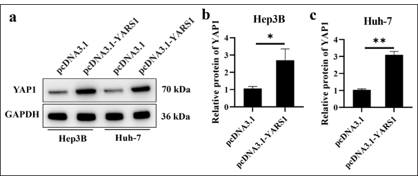 Tyrosyl-tRNA synthetase 1 increased yes-associated protein 1 (YAP1) activity. (a-c) Western blot tests were conducted on YAP1 in Hep3B and Huh-7 cells after transfection with specified plasmids. n = 3. ✶ P < 0.05, ✶✶ P < 0.01. GAPDH: Glyceraldehyde-3-phosphate dehydrogenase.